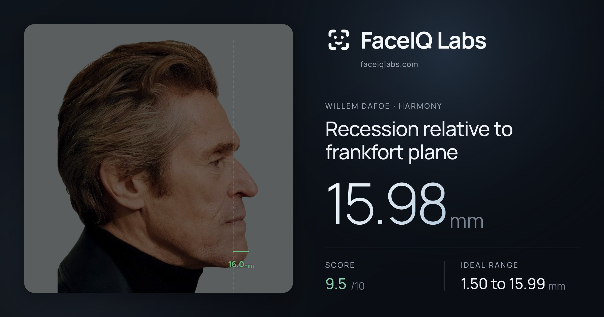 Willem Dafoe Recession relative to frankfort plane: 15.98mm, drawn on the photo