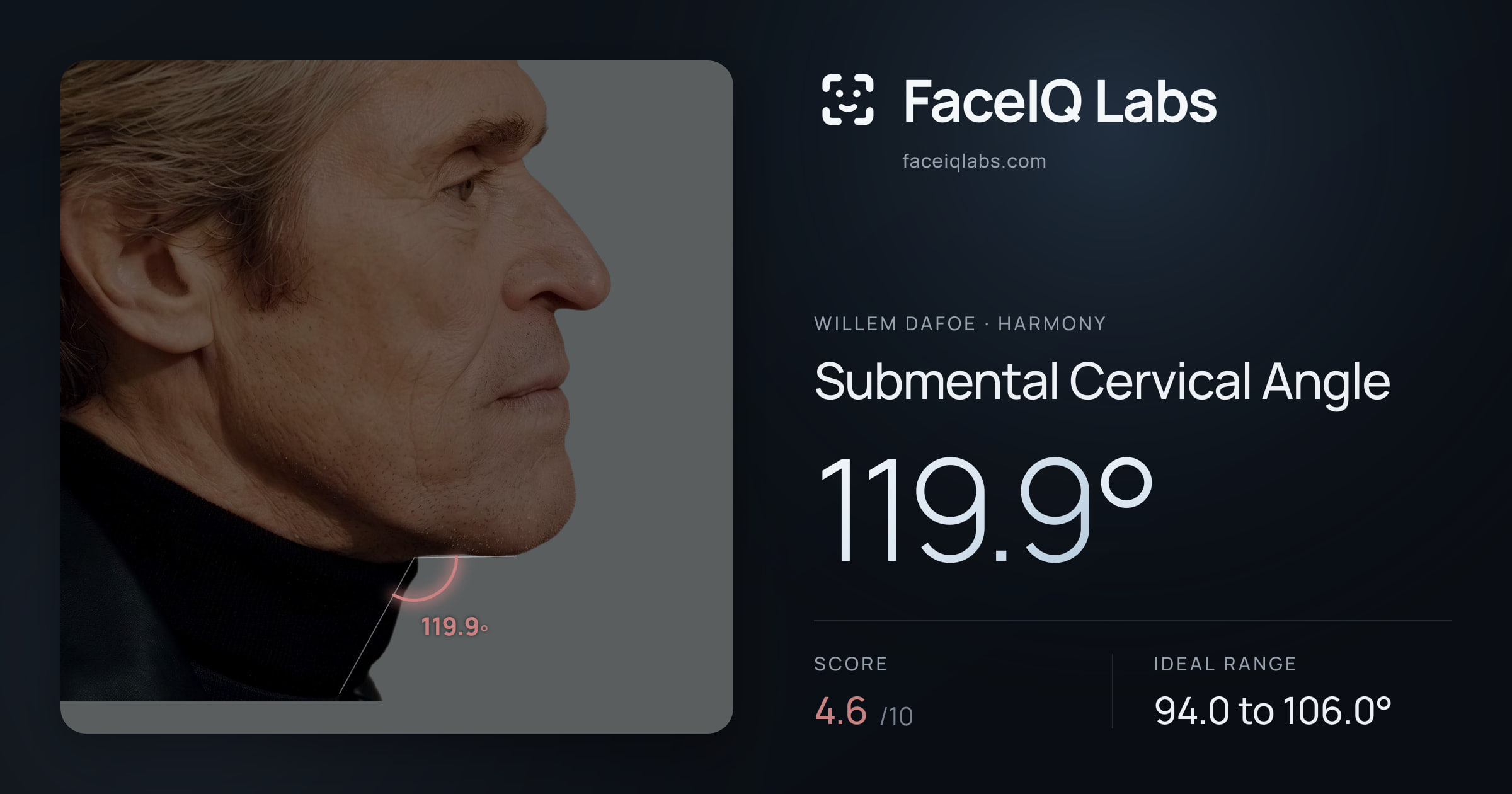 Willem Dafoe Submental Cervical Angle: 119.9°, drawn on the photo