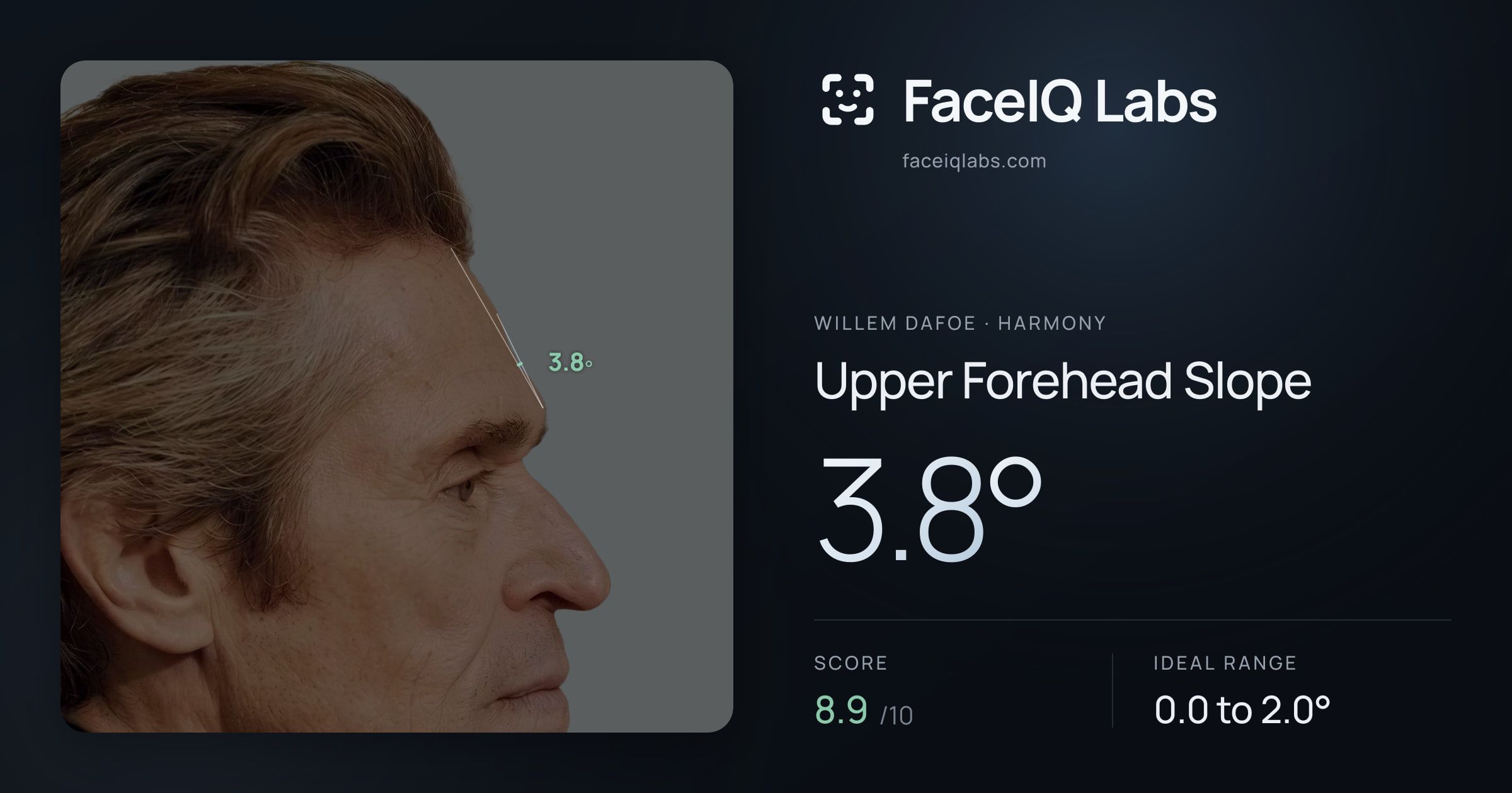 Willem Dafoe Upper Forehead Slope: 3.8°, drawn on the photo