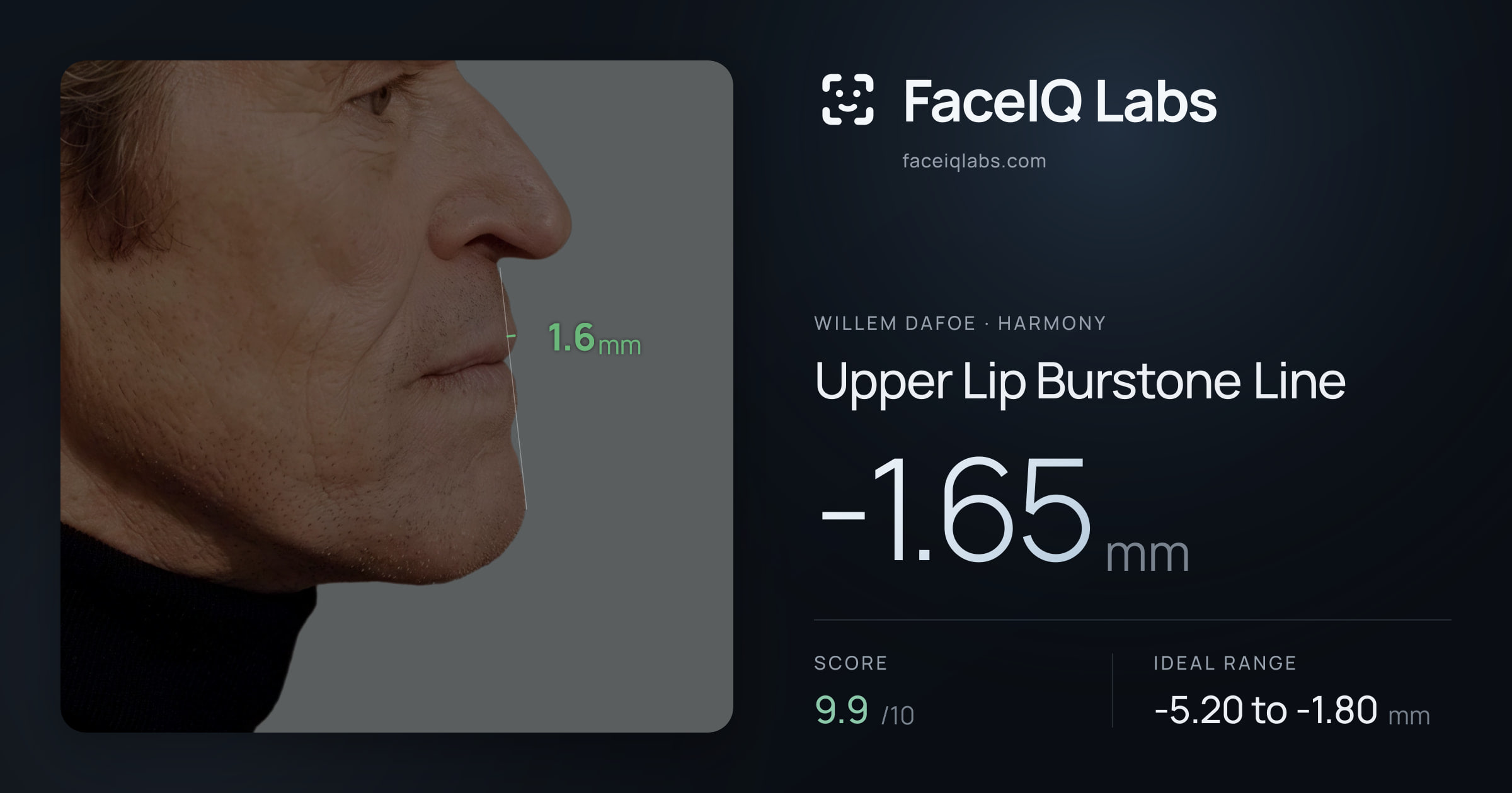 Willem Dafoe Upper Lip Burstone Line: -1.65mm, drawn on the photo