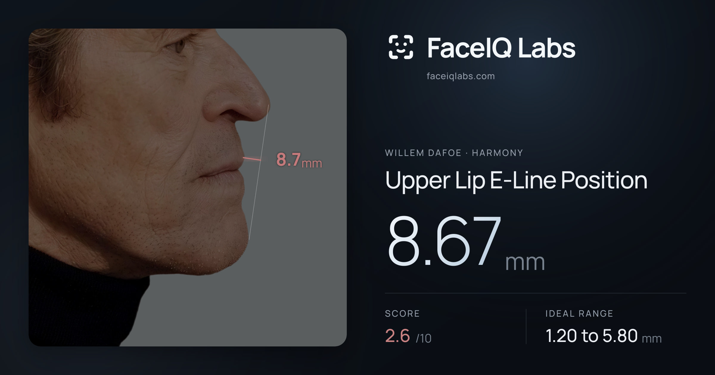 Willem Dafoe Upper Lip E-Line Position: 8.67mm, drawn on the photo