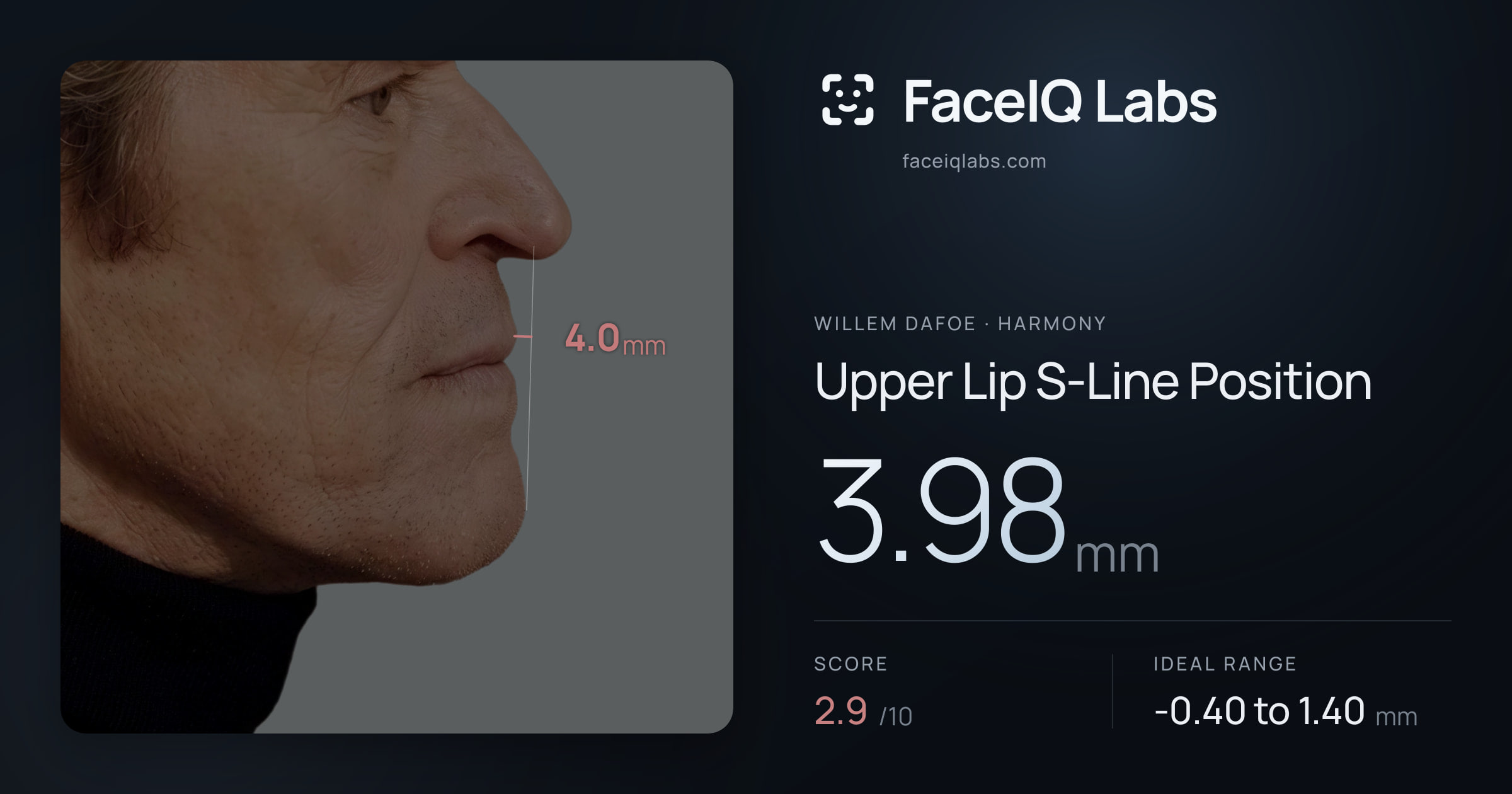 Willem Dafoe Upper Lip S-Line Position: 3.98mm, drawn on the photo