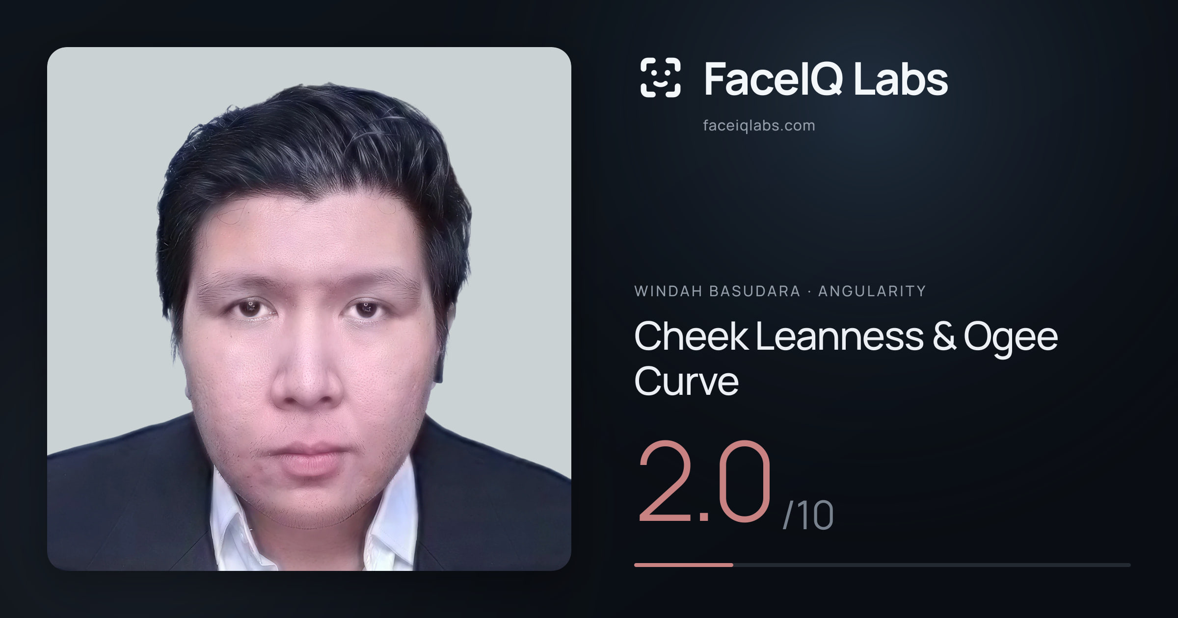 Windah Basudara Cheek Leanness & Ogee Curve: 2.0/10, drawn on the photo
