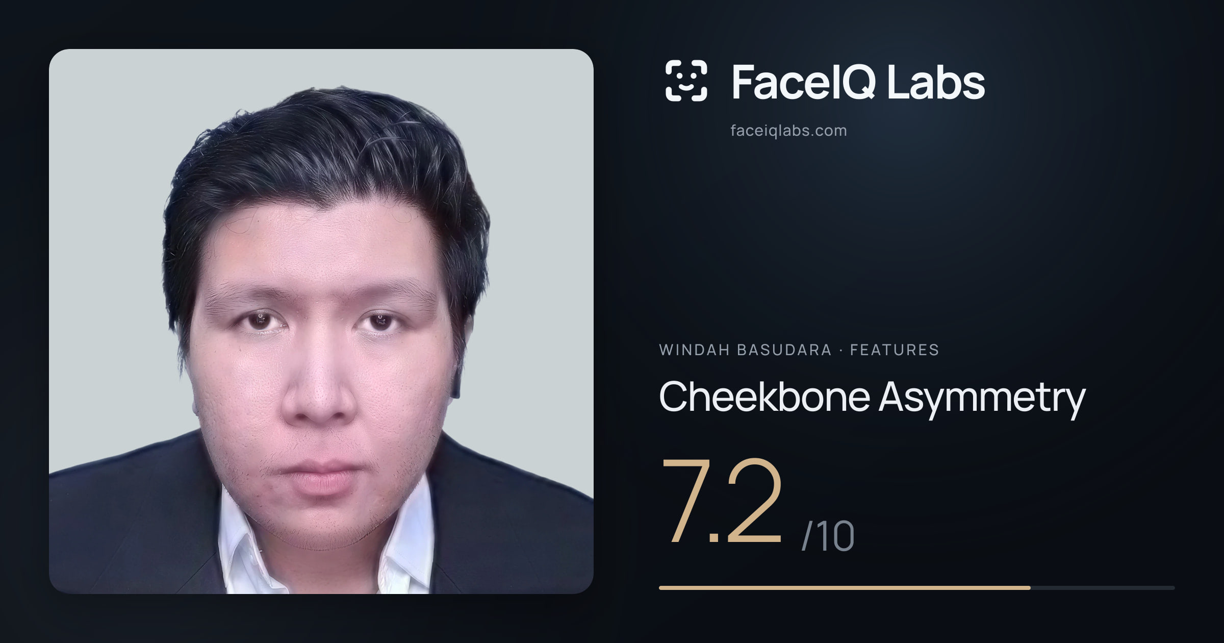 Windah Basudara Cheekbone Asymmetry: 7.2/10, drawn on the photo