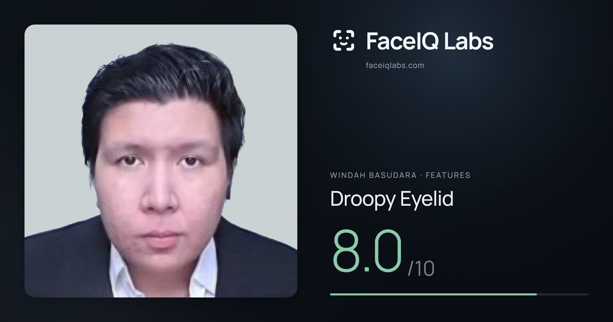 Windah Basudara Droopy Eyelid: 8.0/10, drawn on the photo