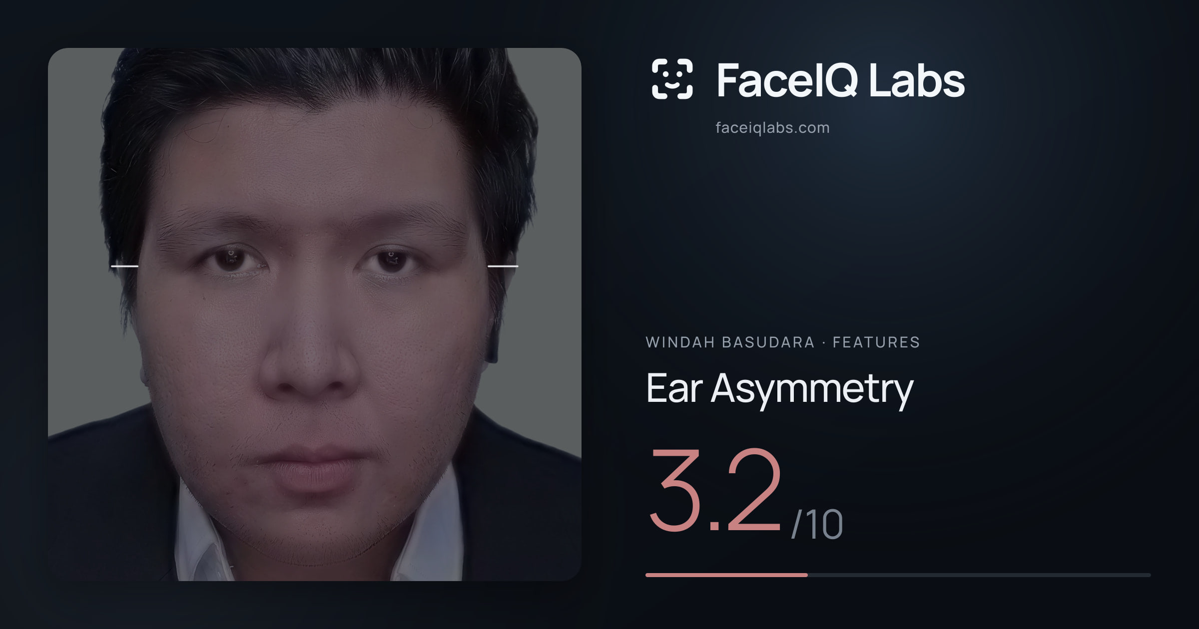 Windah Basudara Ear Asymmetry: 3.2/10, drawn on the photo