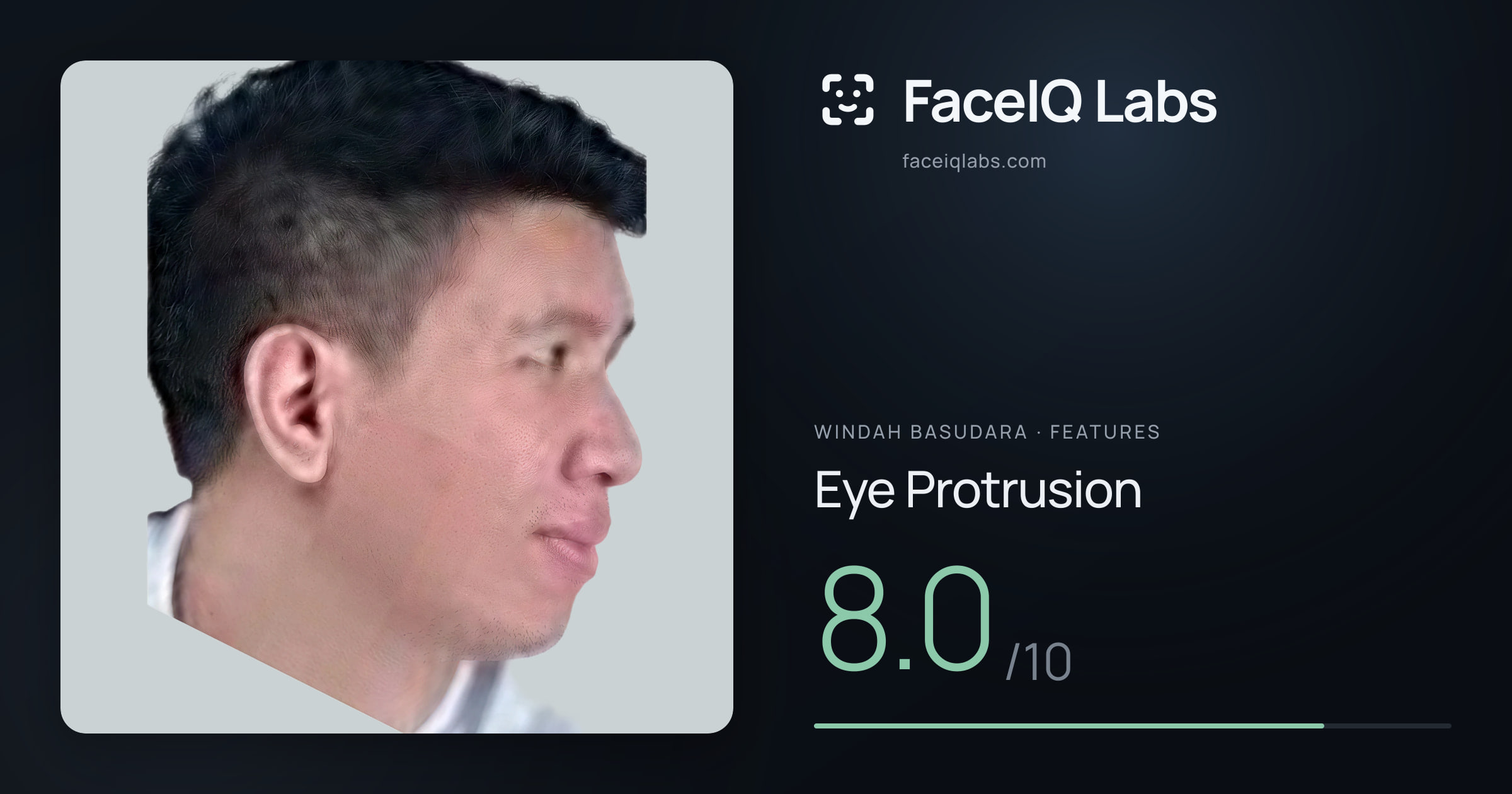 Windah Basudara Eye Protrusion: 8.0/10, drawn on the photo