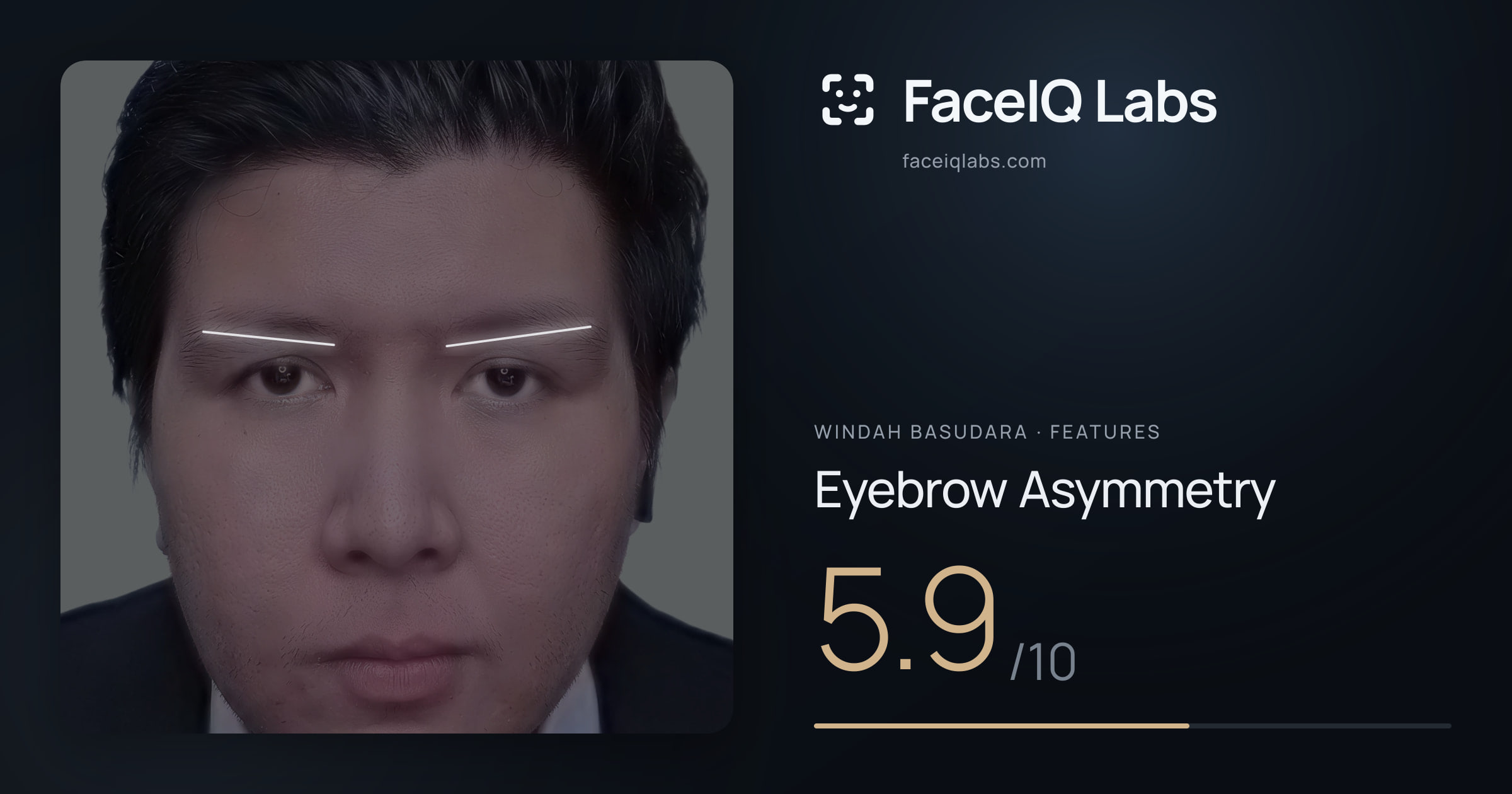 Windah Basudara Eyebrow Asymmetry: 5.9/10, drawn on the photo