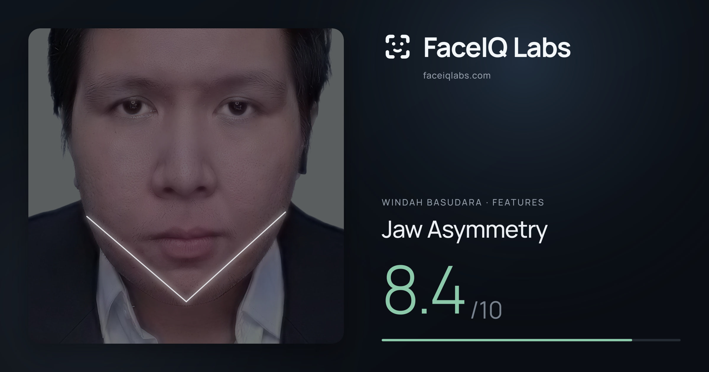 Windah Basudara Jaw Asymmetry: 8.4/10, drawn on the photo
