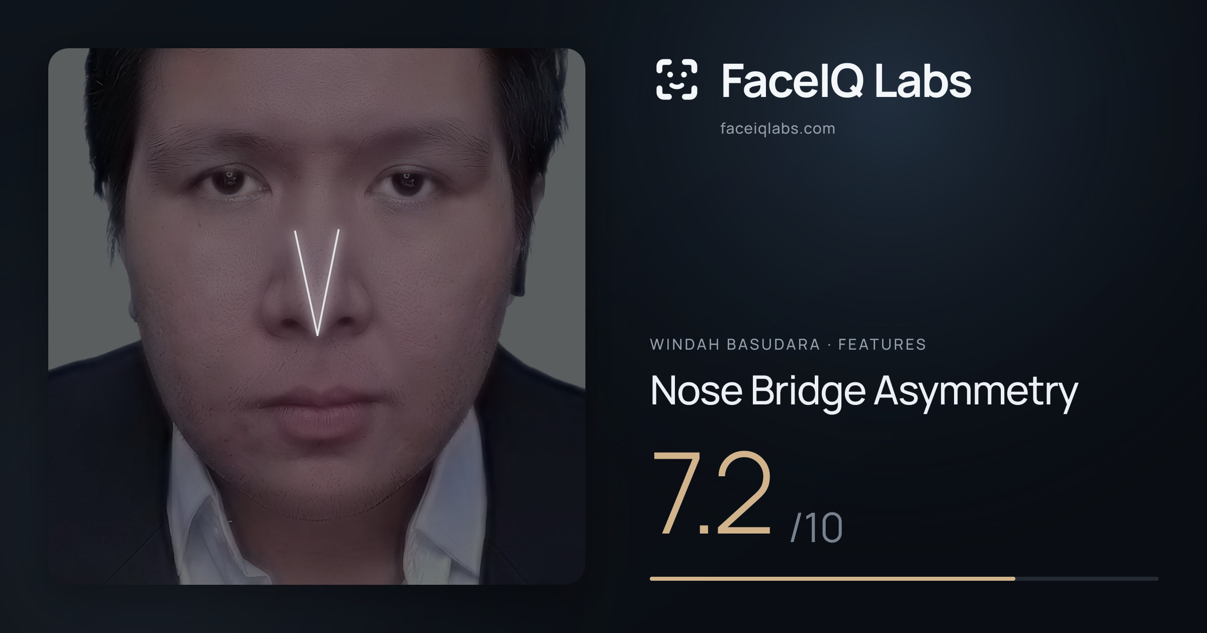 Windah Basudara Nose Bridge Asymmetry: 7.2/10, drawn on the photo