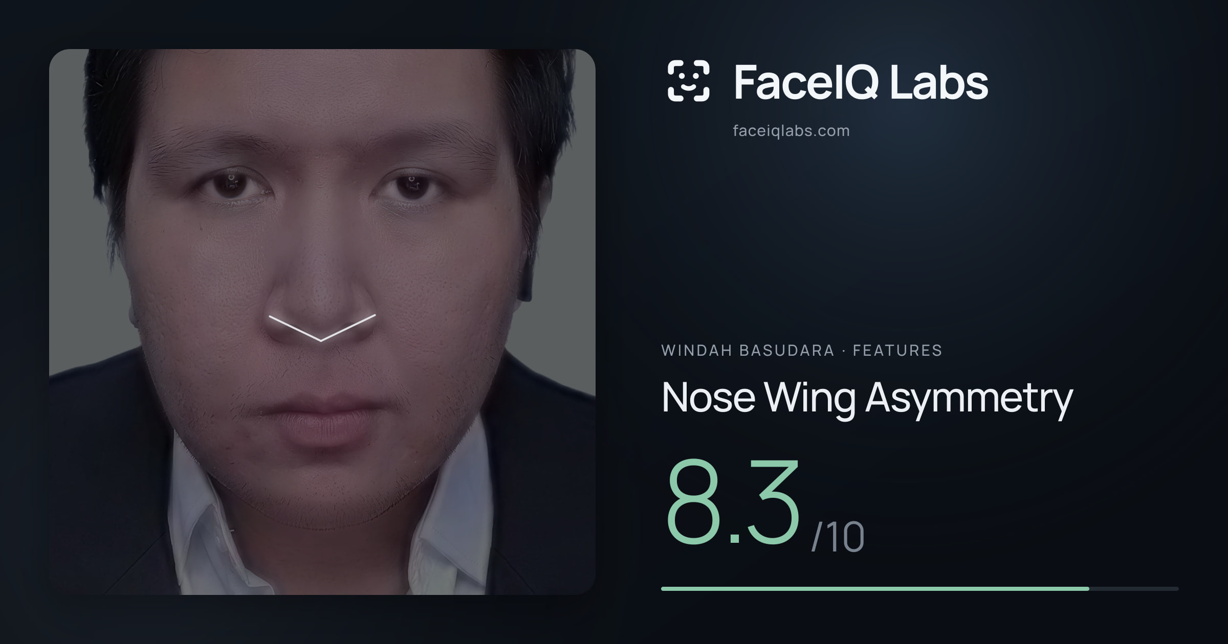 Windah Basudara Nose Wing Asymmetry: 8.3/10, drawn on the photo