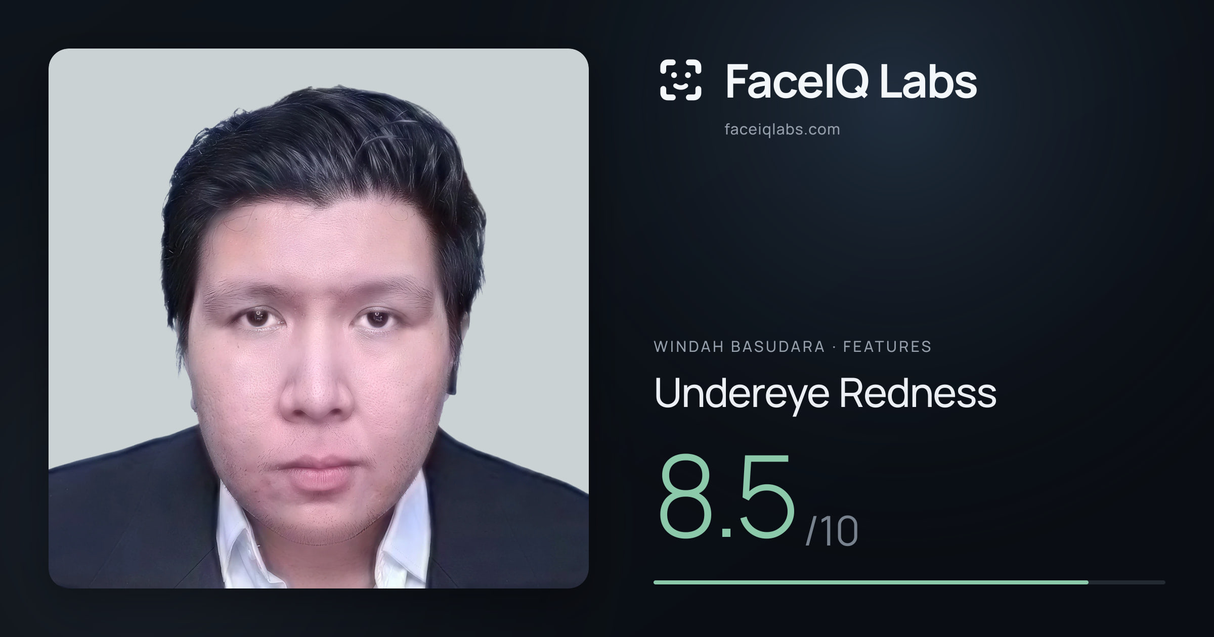 Windah Basudara Undereye Redness: 8.5/10, drawn on the photo