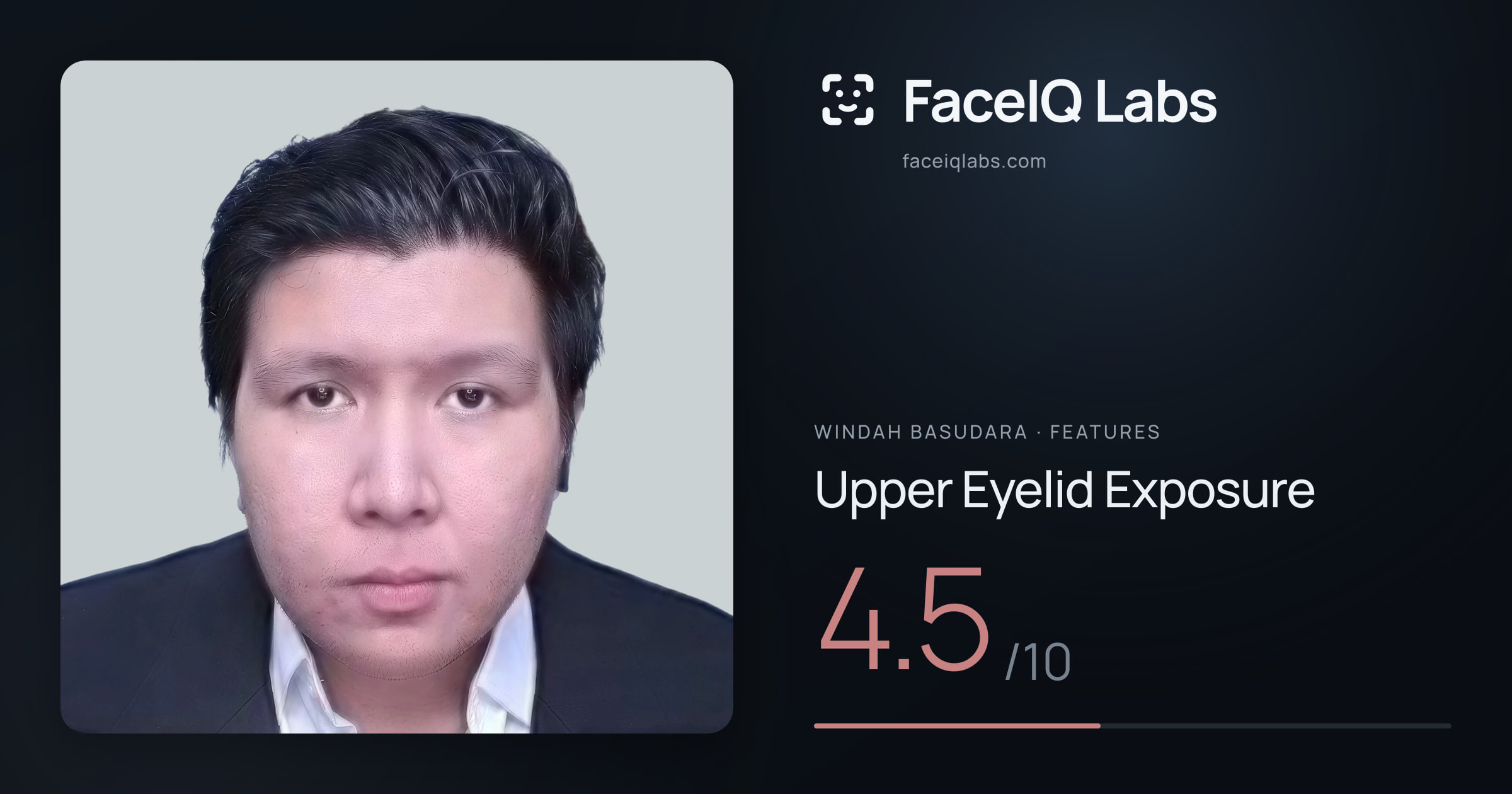 Windah Basudara Upper Eyelid Exposure: 4.5/10, drawn on the photo