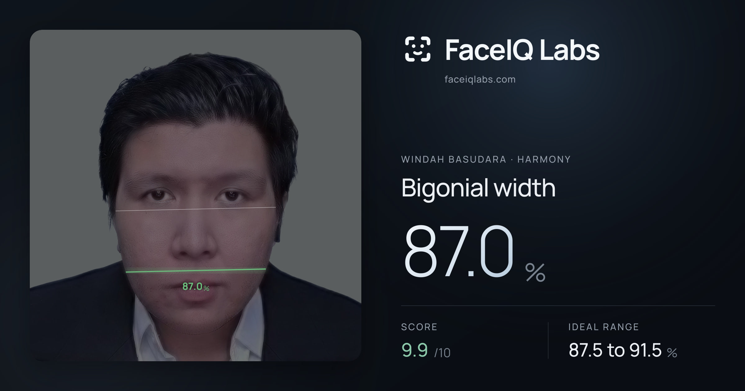 Windah Basudara Bigonial width: 87.0%, drawn on the photo