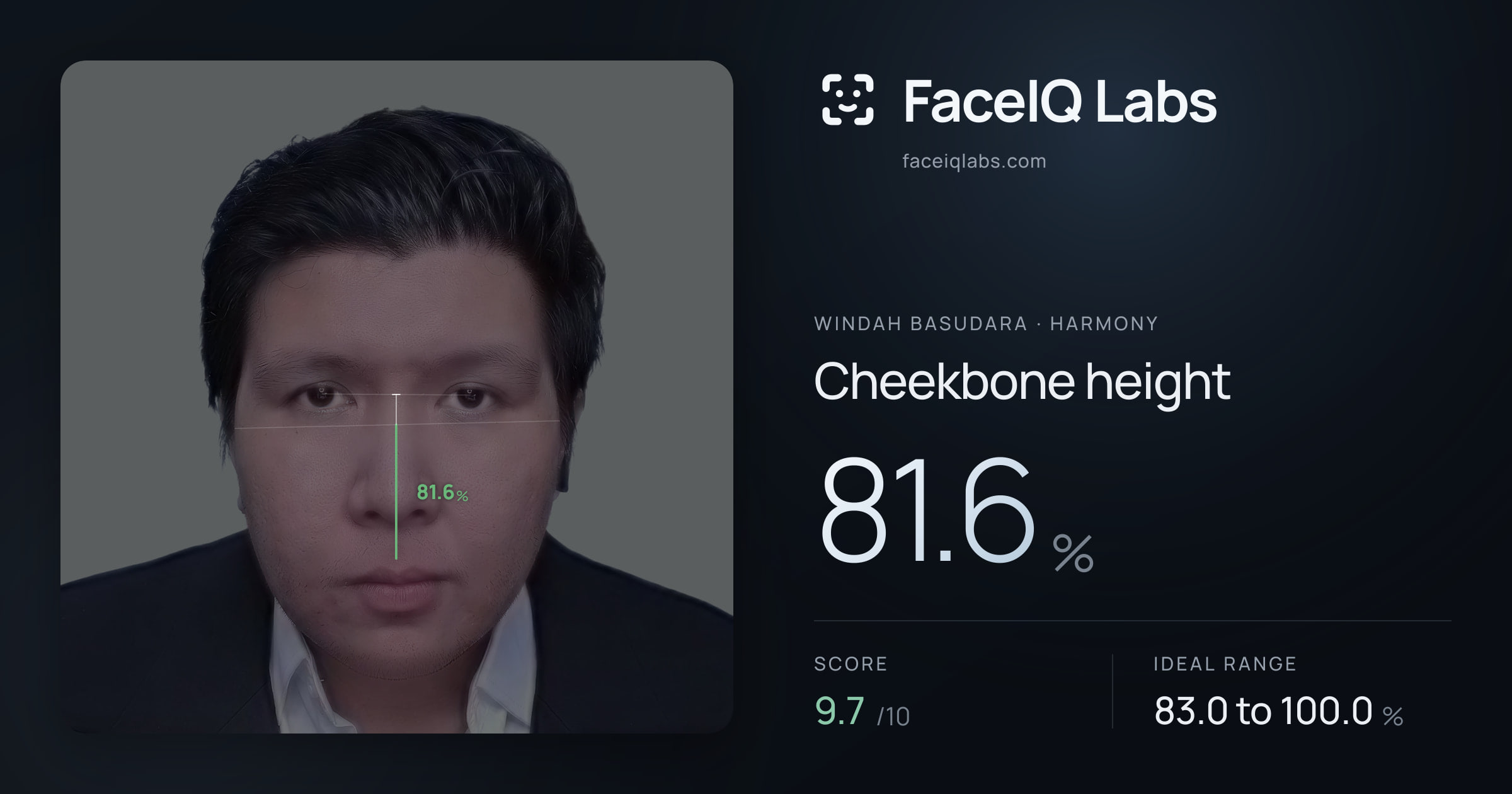 Windah Basudara Cheekbone height: 81.6%, drawn on the photo