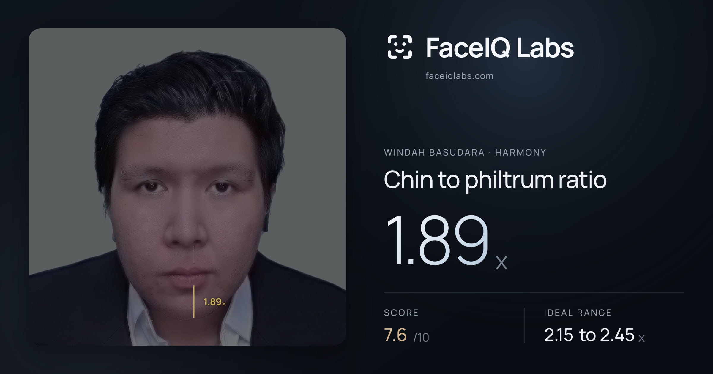 Windah Basudara Chin to philtrum ratio: 1.89x, drawn on the photo