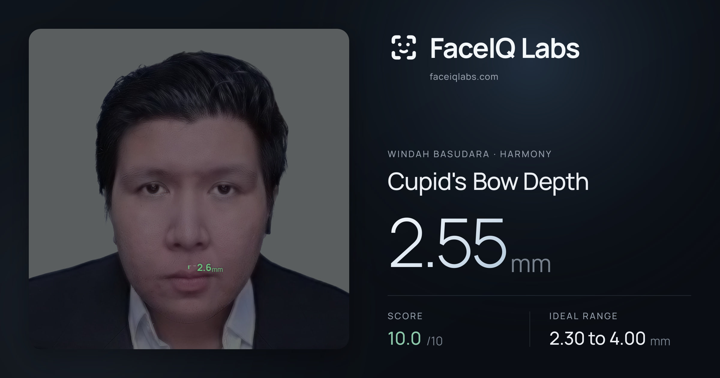 Windah Basudara Cupid's Bow Depth: 2.55mm, drawn on the photo
