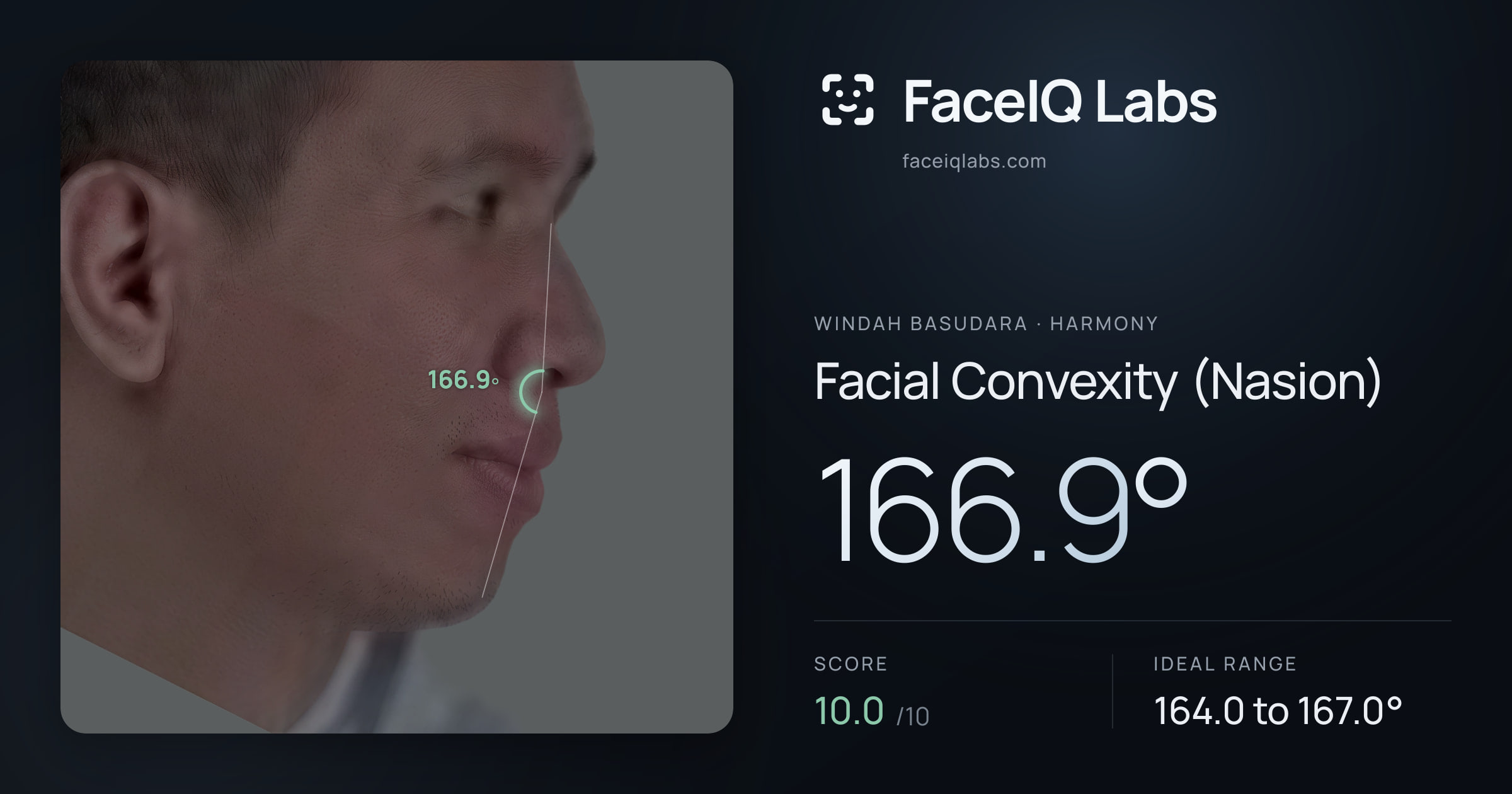 Windah Basudara Facial Convexity (Nasion): 166.9°, drawn on the photo