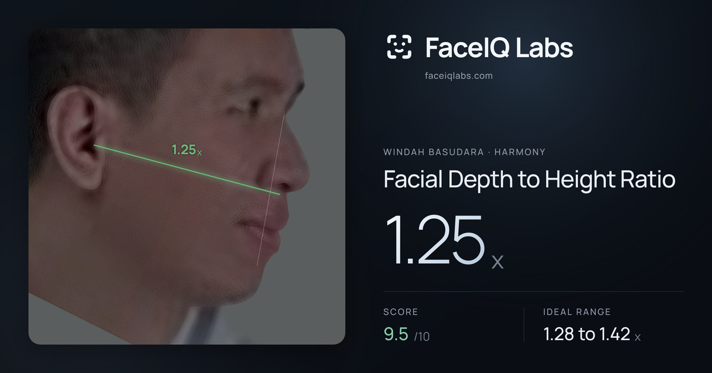 Windah Basudara Facial Depth to Height Ratio: 1.25x, drawn on the photo