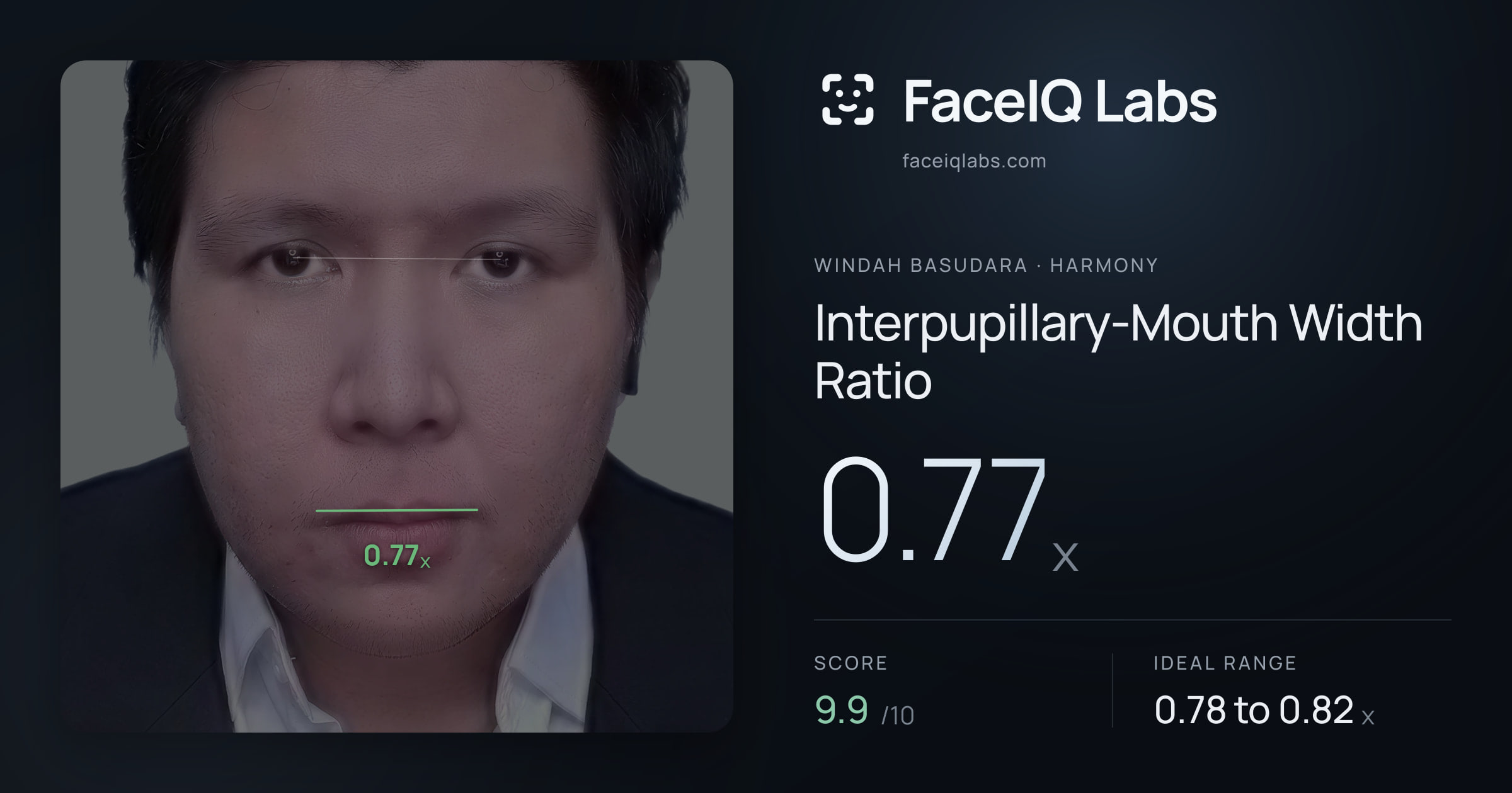 Windah Basudara Interpupillary-Mouth Width Ratio: 0.77x, drawn on the photo