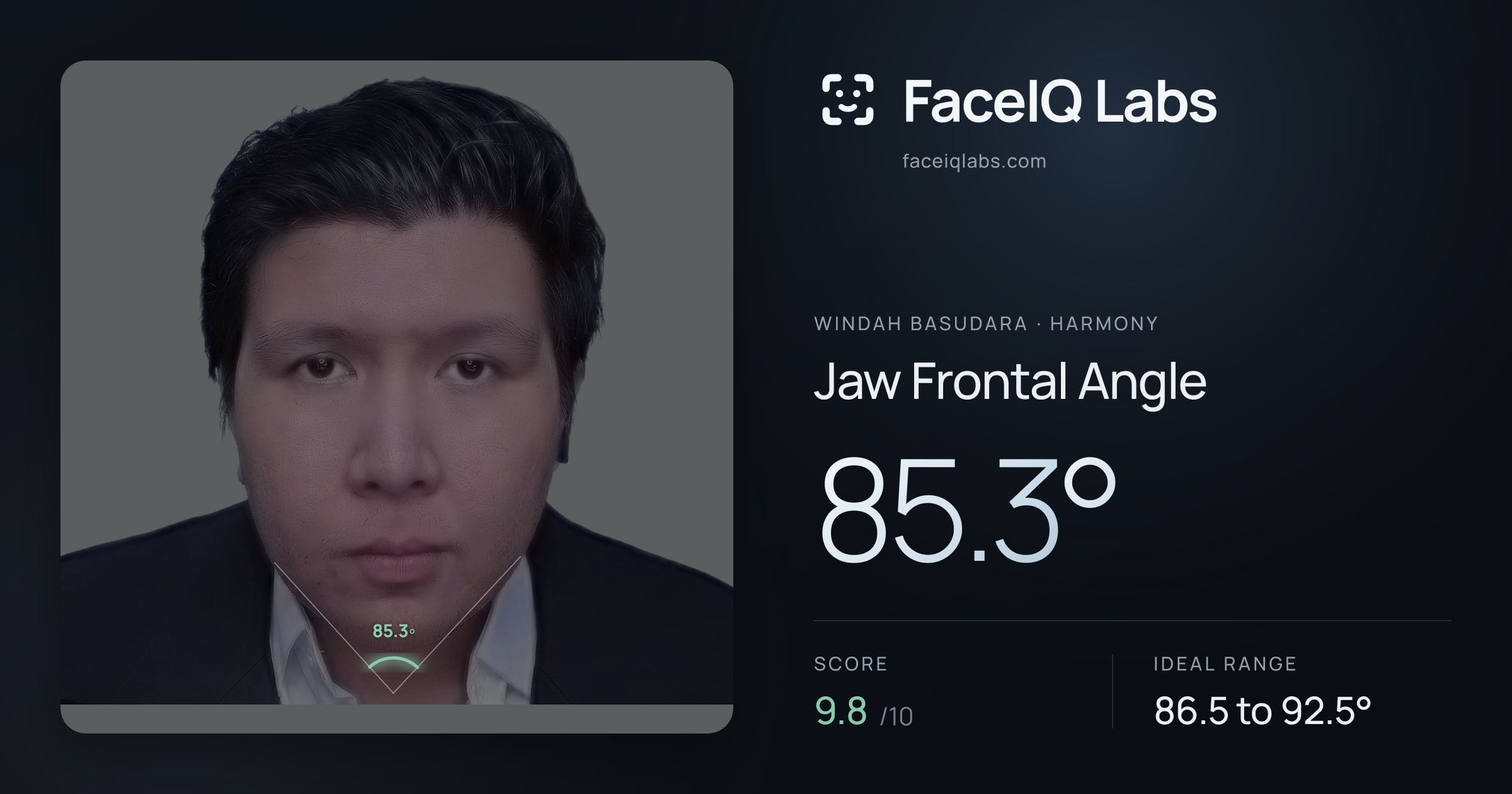 Windah Basudara Jaw Frontal Angle: 85.3°, drawn on the photo