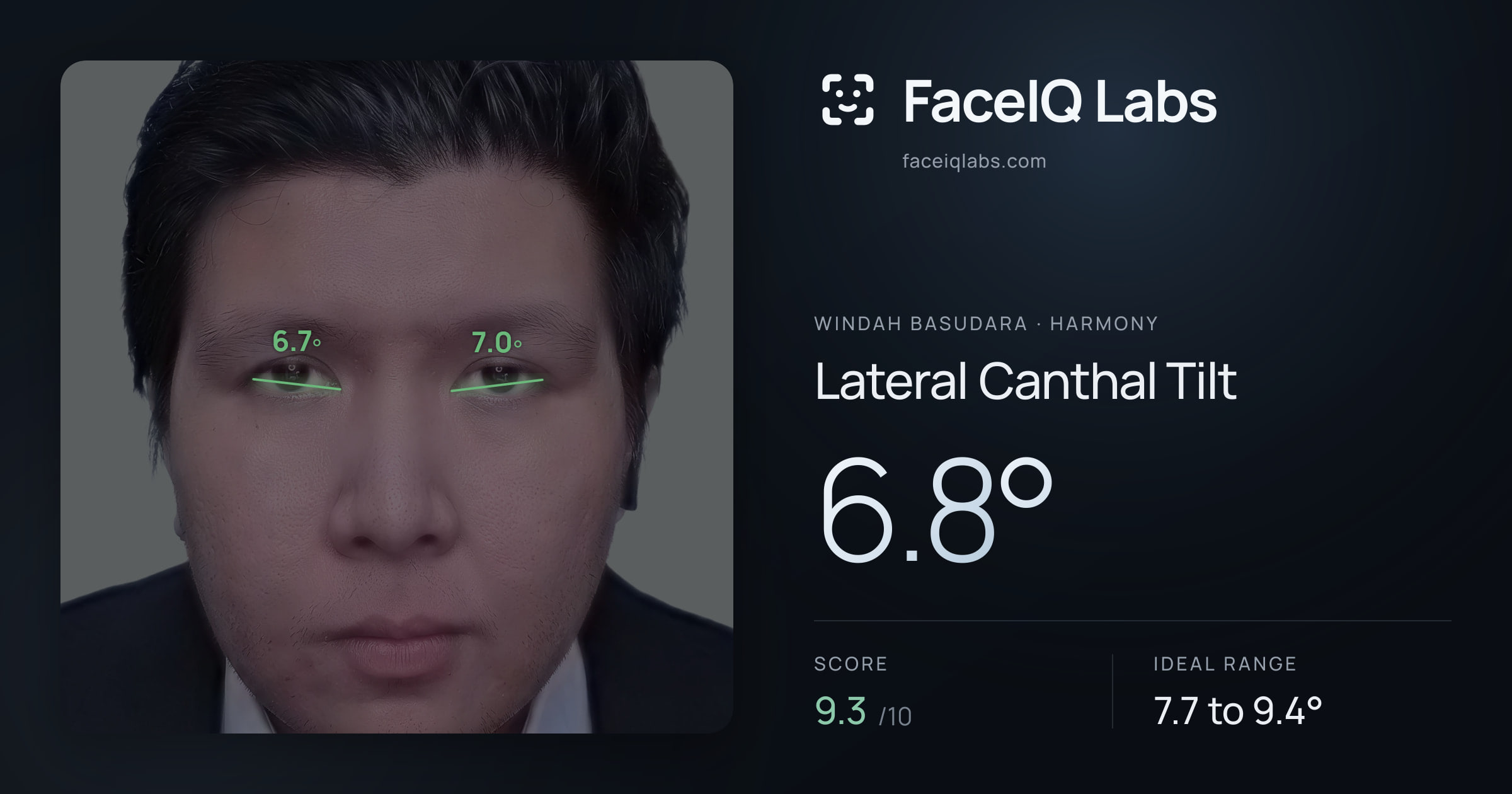 Windah Basudara Lateral Canthal Tilt: 6.8°, drawn on the photo