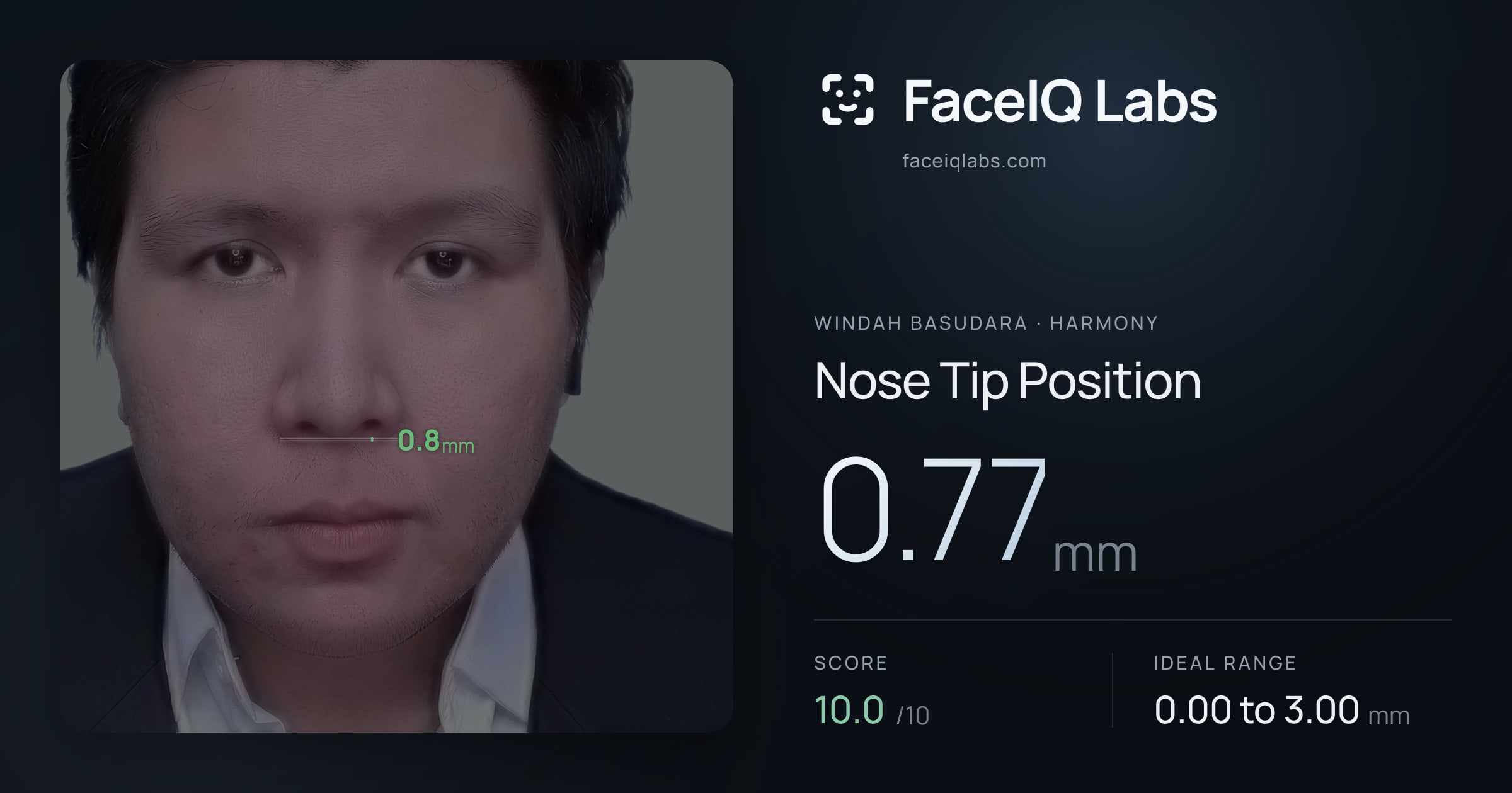 Windah Basudara Nose Tip Position: 0.77mm, drawn on the photo