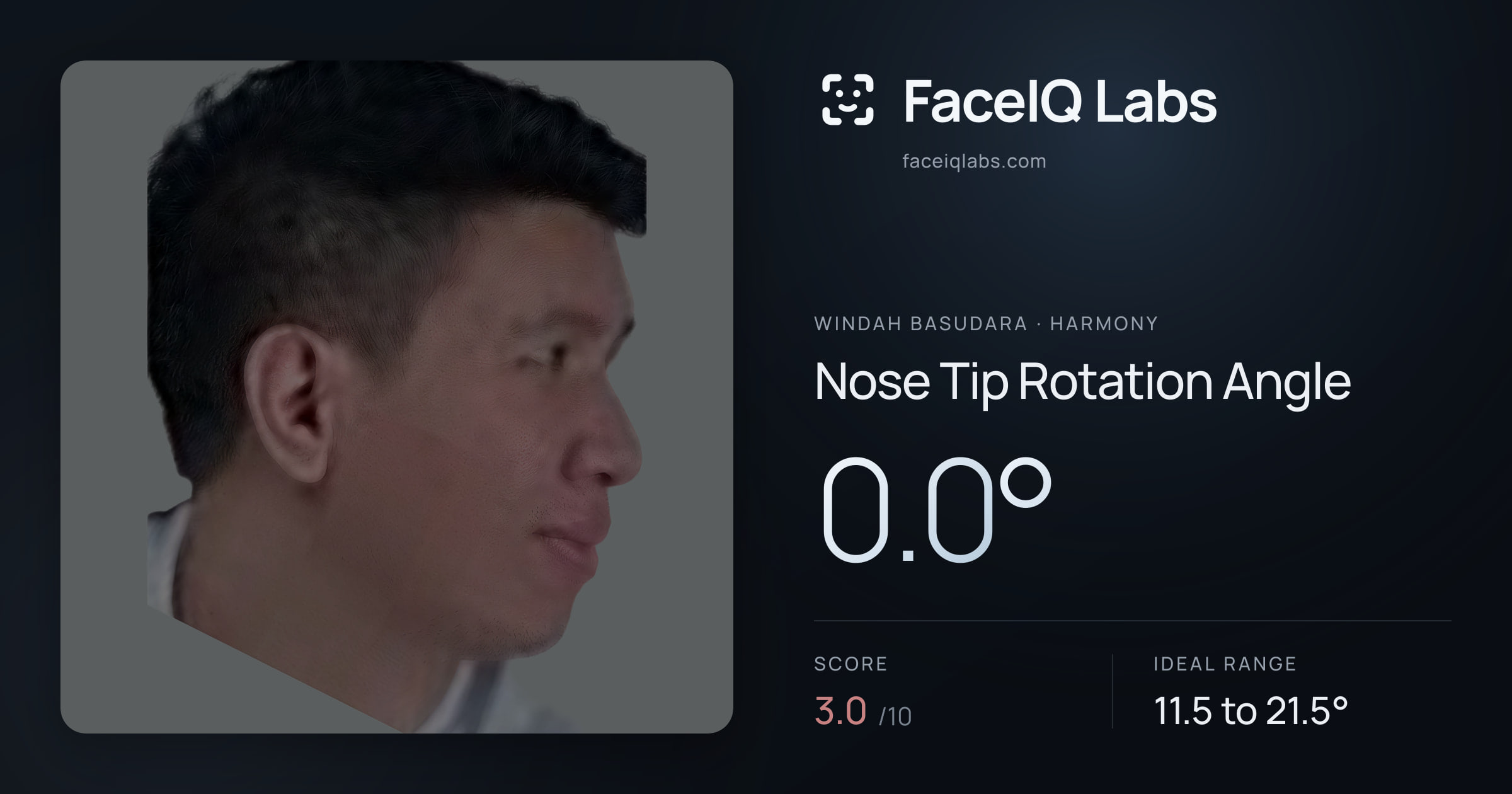 Windah Basudara Nose Tip Rotation Angle: 0.0°, drawn on the photo