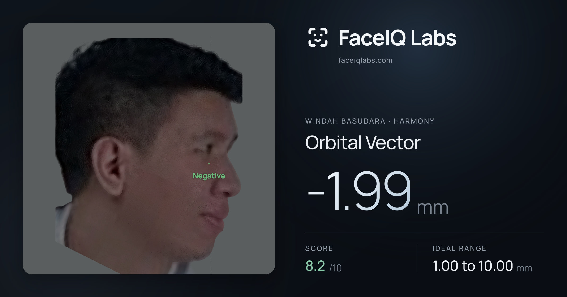 Windah Basudara Orbital Vector: -1.99mm, drawn on the photo