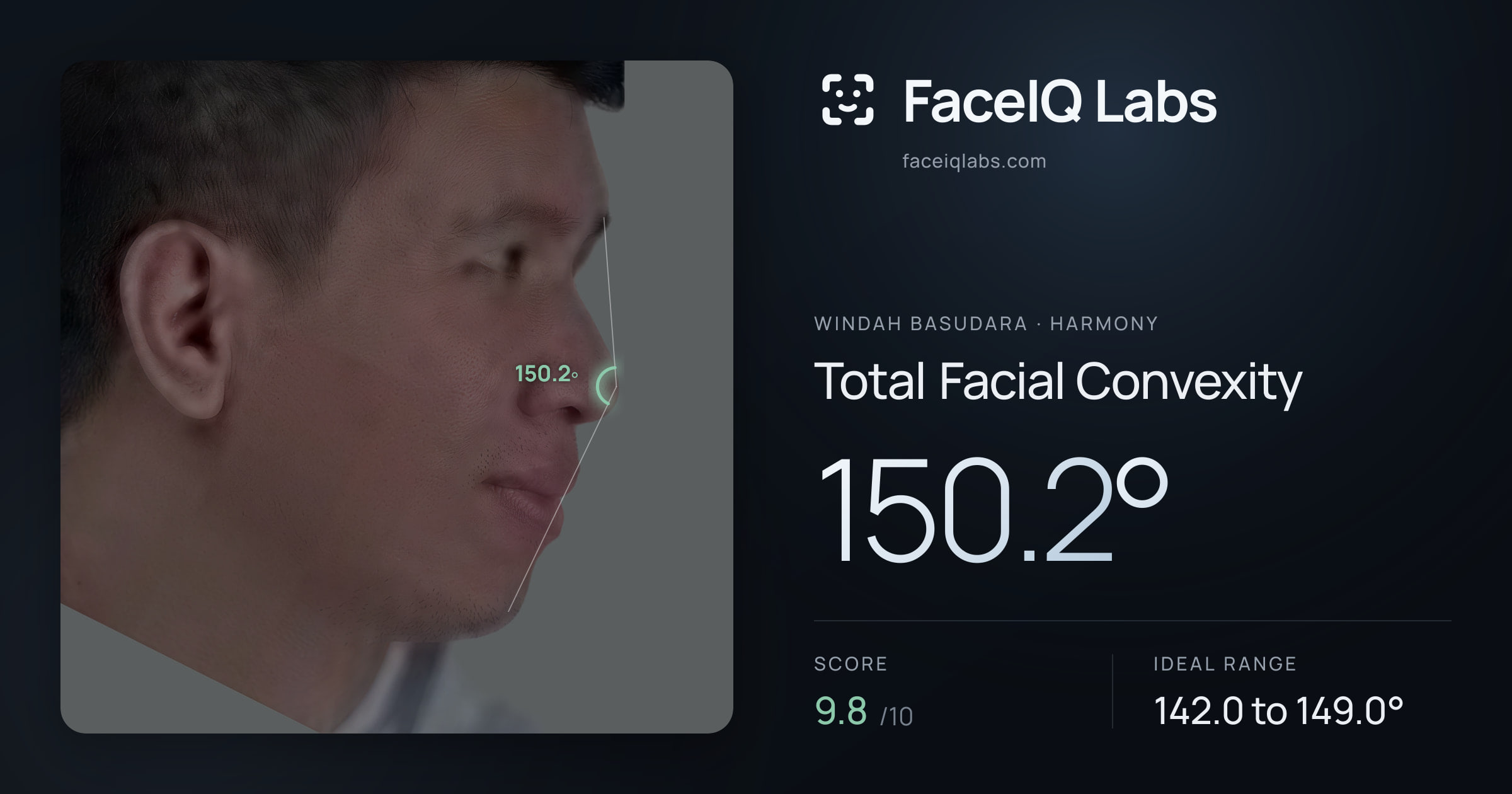 Windah Basudara Total Facial Convexity: 150.2°, drawn on the photo