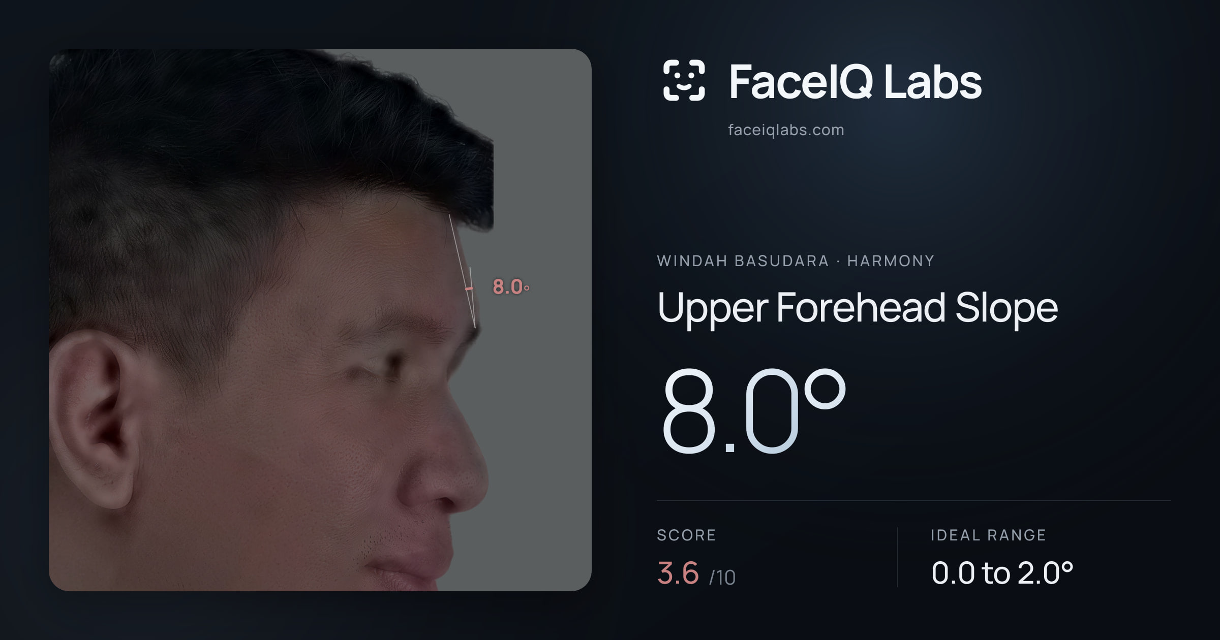 Windah Basudara Upper Forehead Slope: 8.0°, drawn on the photo