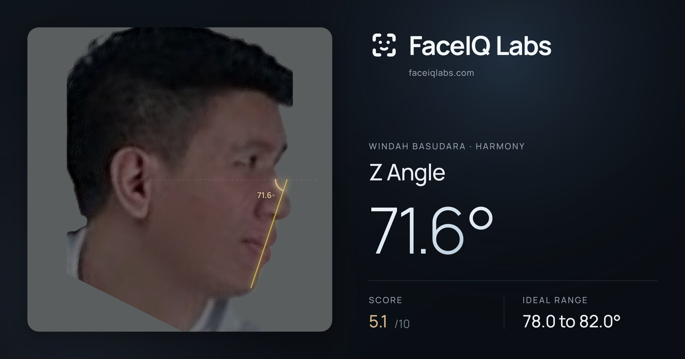 Windah Basudara Z Angle: 71.6°, drawn on the photo
