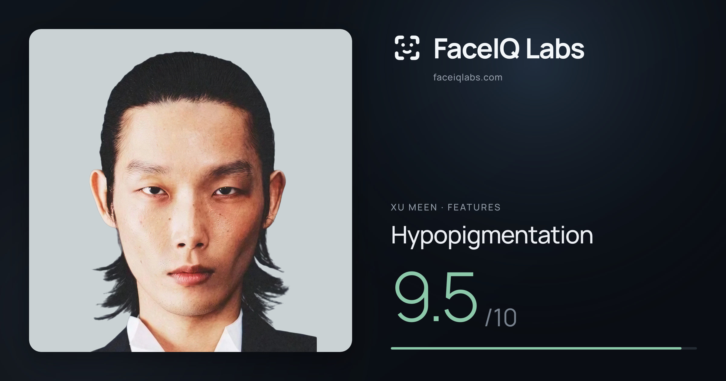 Xu Meen Hypopigmentation: 9.5/10, drawn on the photo