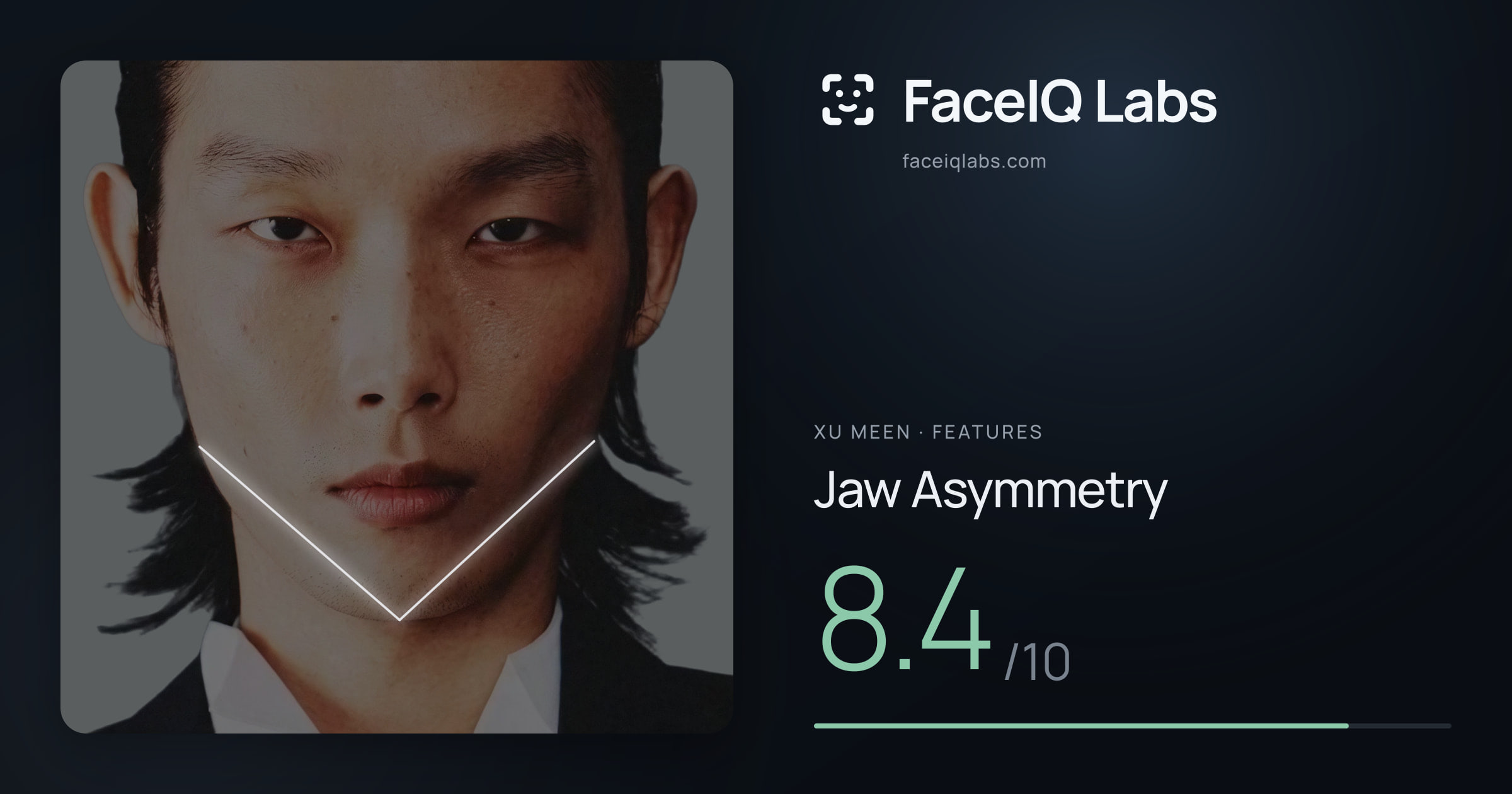Xu Meen Jaw Asymmetry: 8.4/10, drawn on the photo