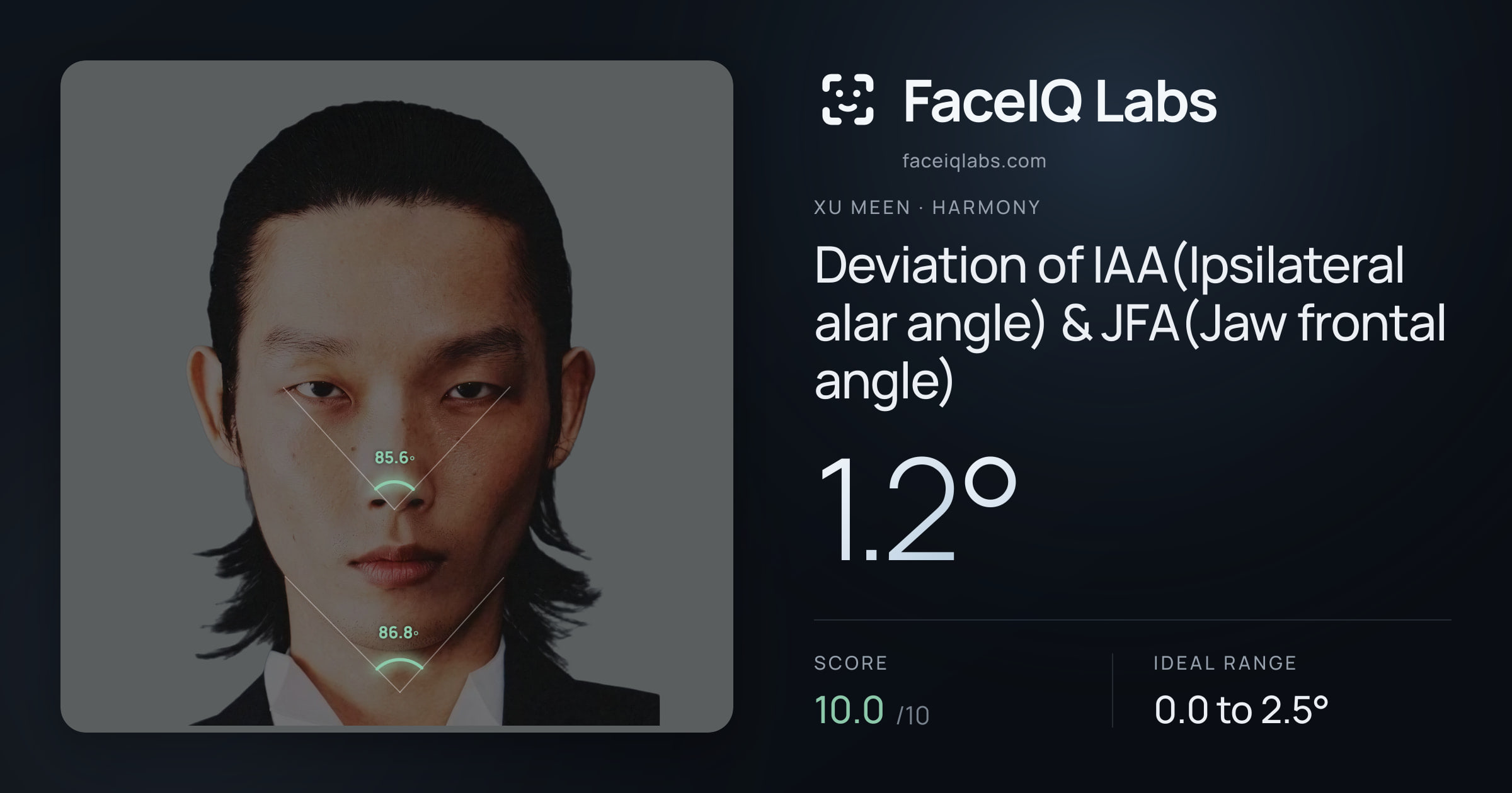 Xu Meen Deviation of IAA(Ipsilateral alar angle) & JFA(Jaw frontal angle): 1.2°, drawn on the photo