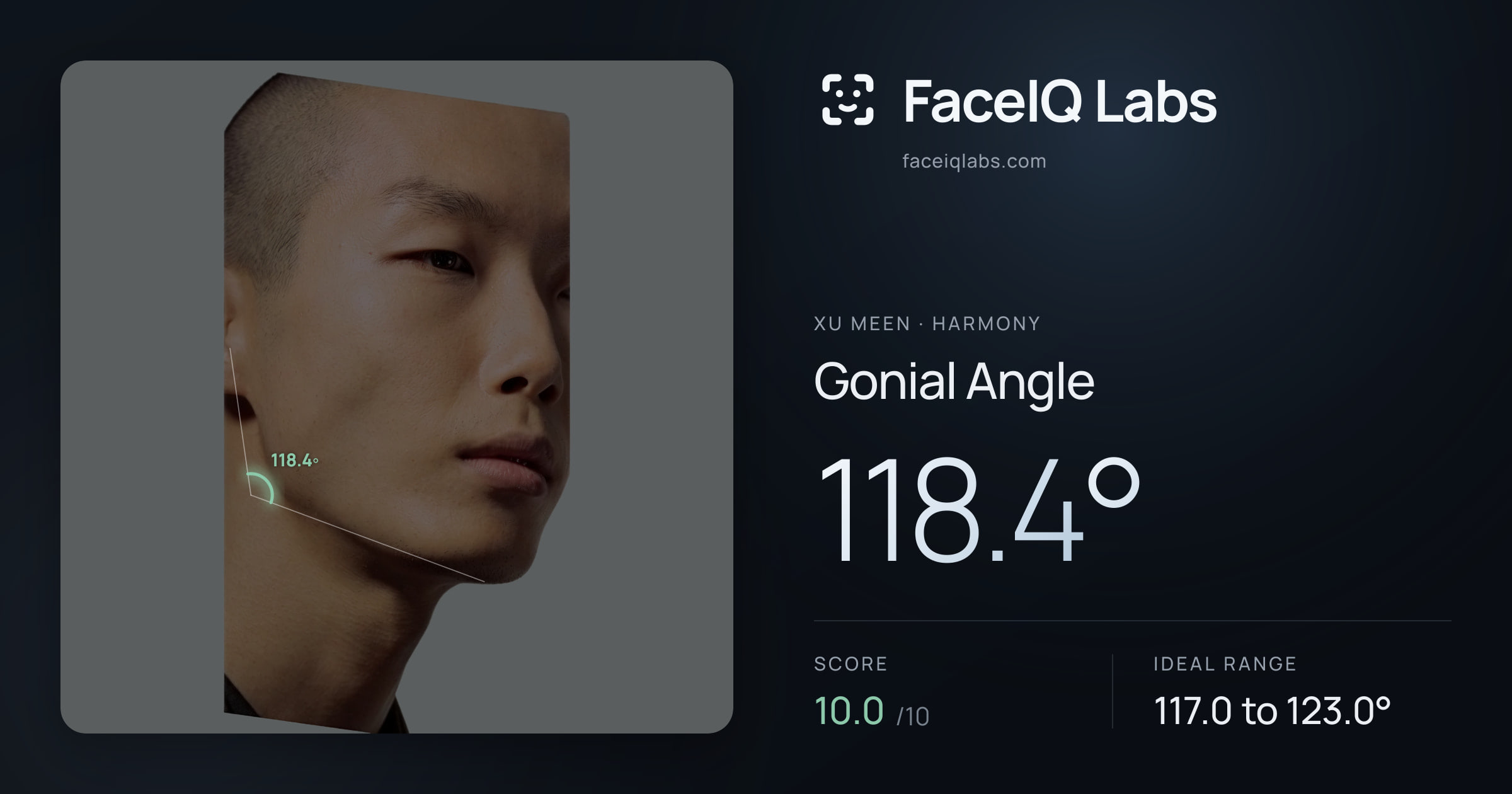 Xu Meen Gonial Angle: 118.4°, drawn on the photo