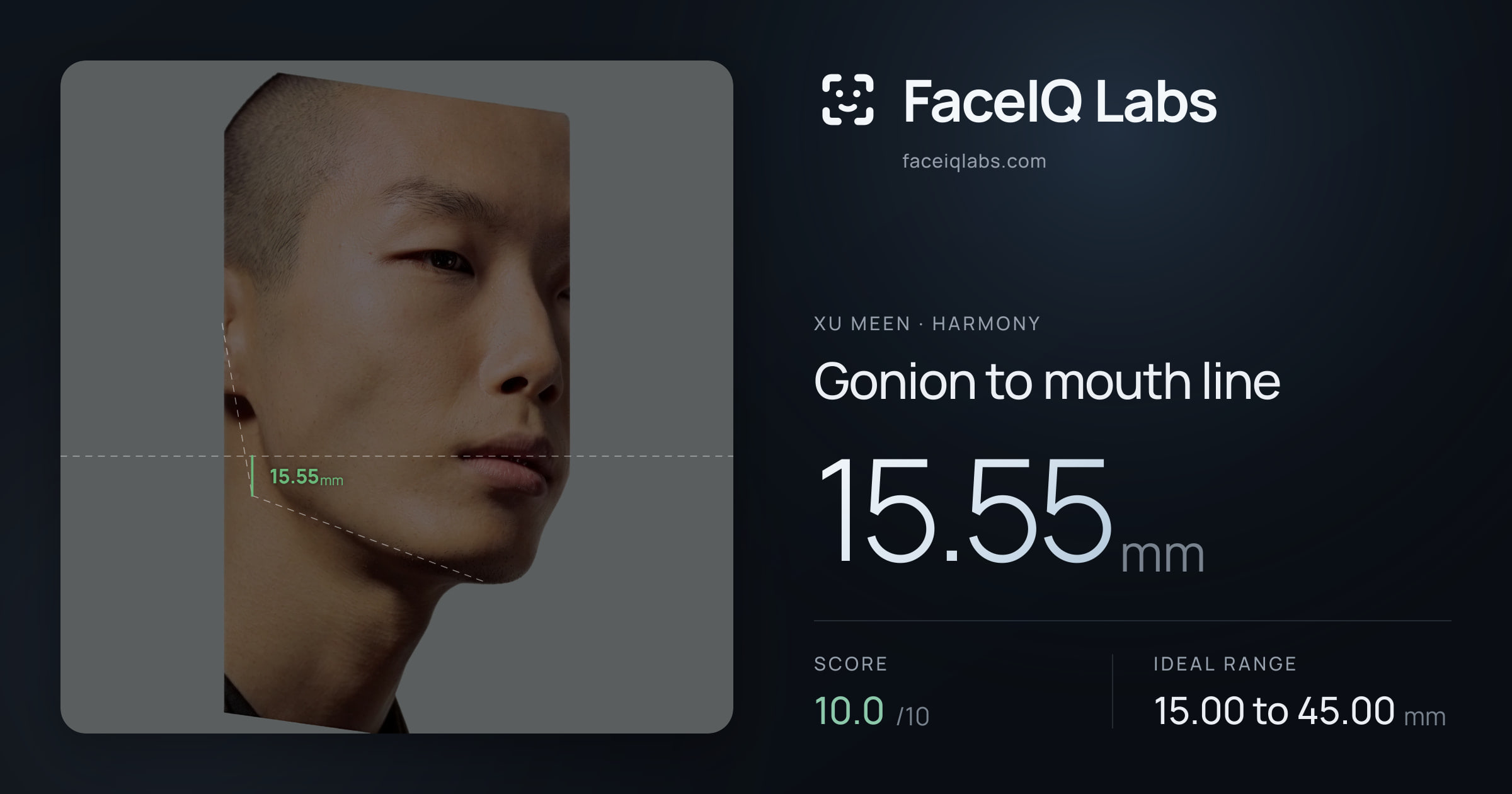Xu Meen Gonion to mouth line: 15.55mm, drawn on the photo