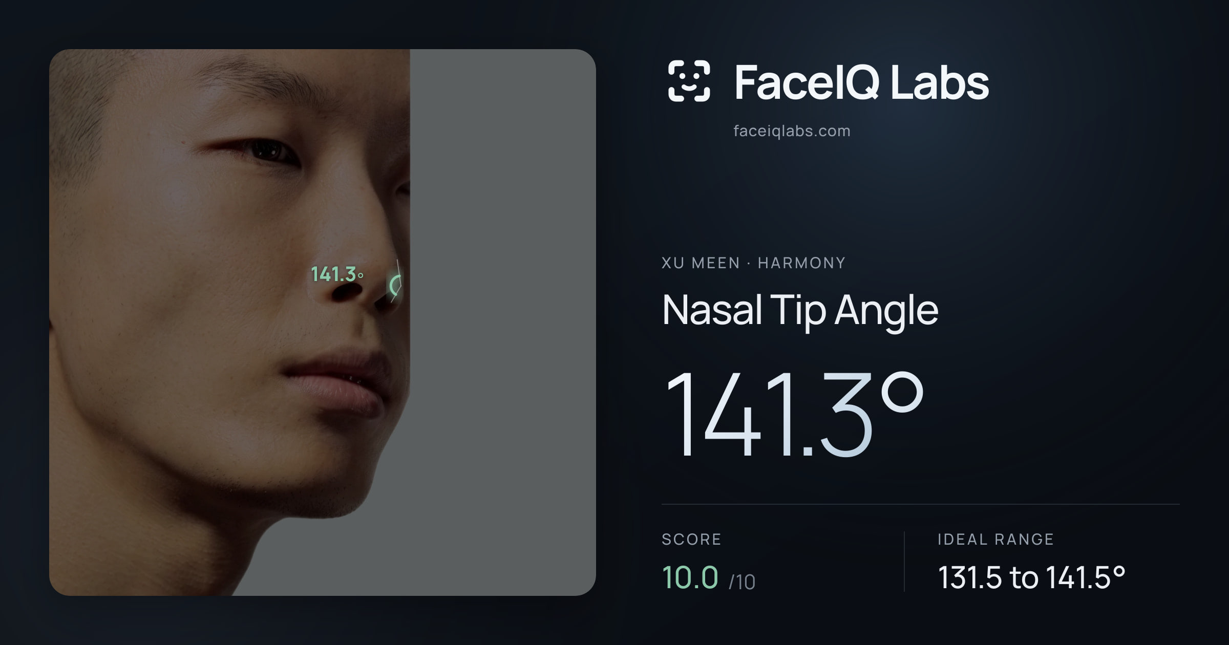 Xu Meen Nasal Tip Angle: 141.3°, drawn on the photo