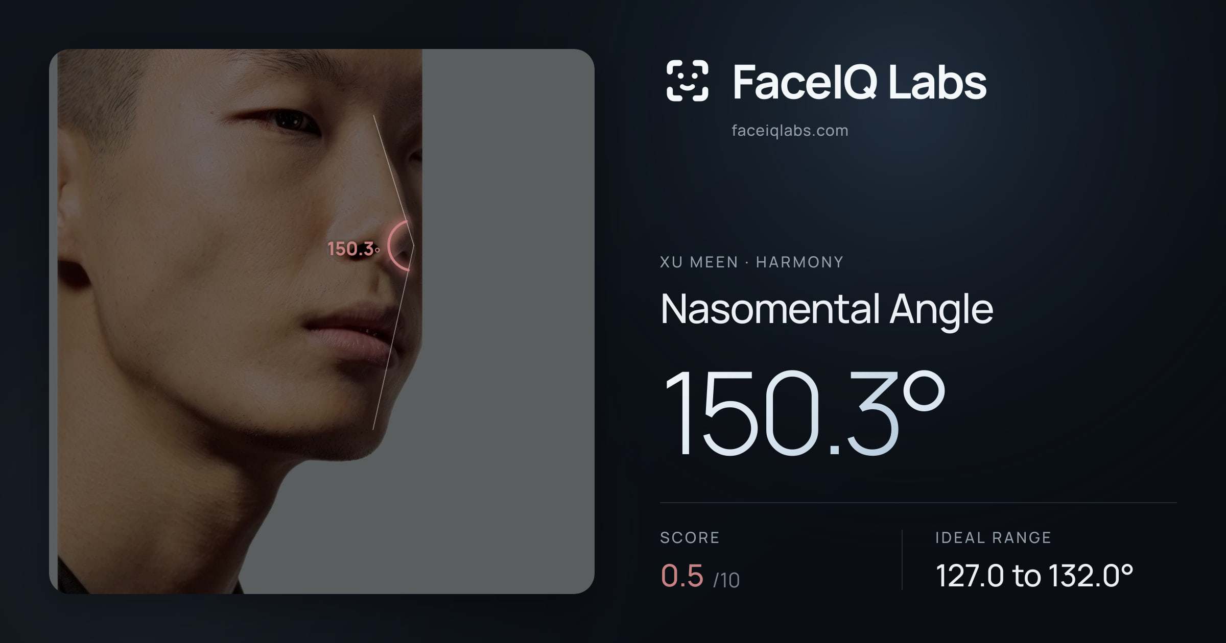 Xu Meen Nasomental Angle: 150.3°, drawn on the photo