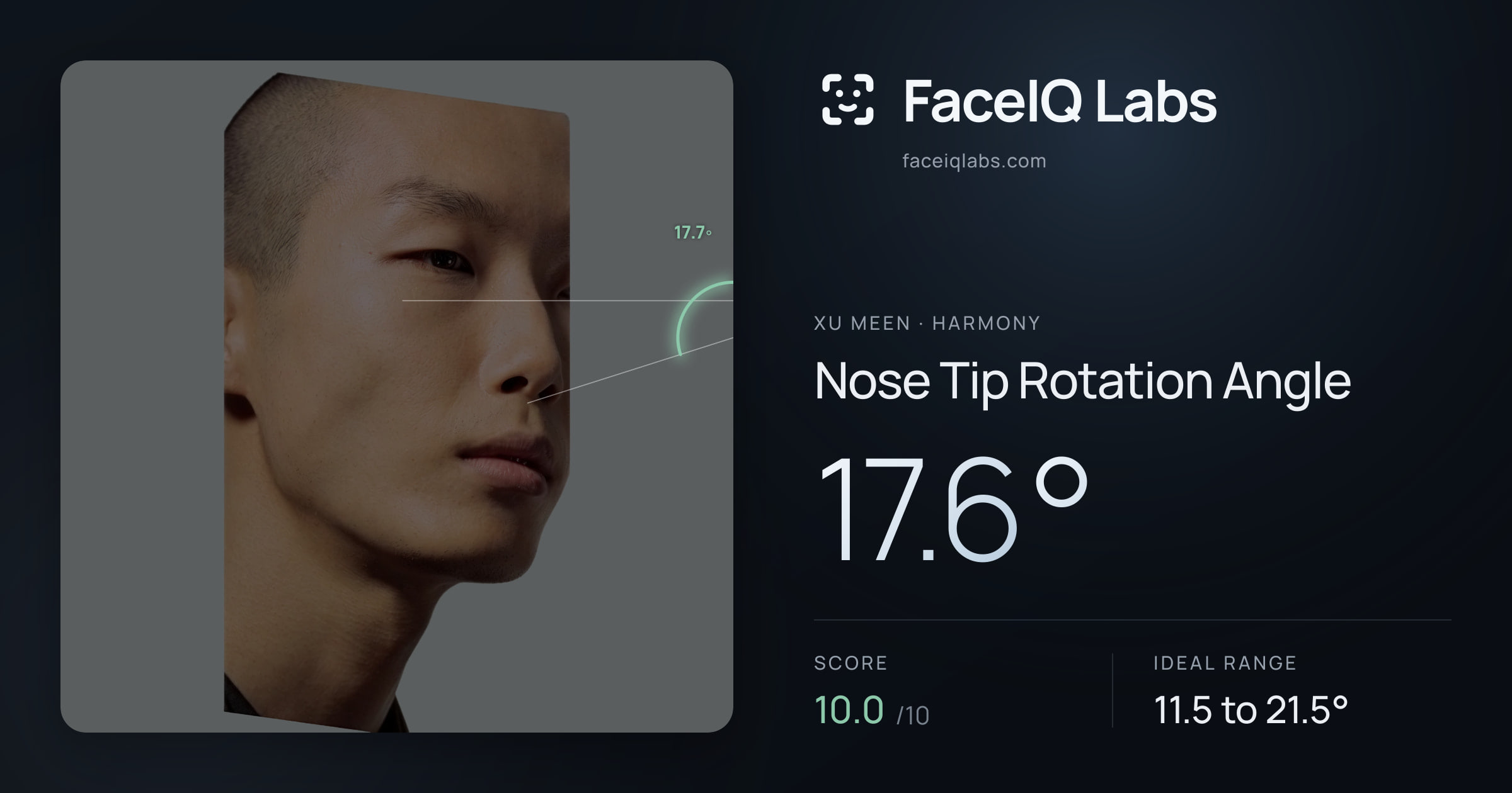 Xu Meen Nose Tip Rotation Angle: 17.6°, drawn on the photo