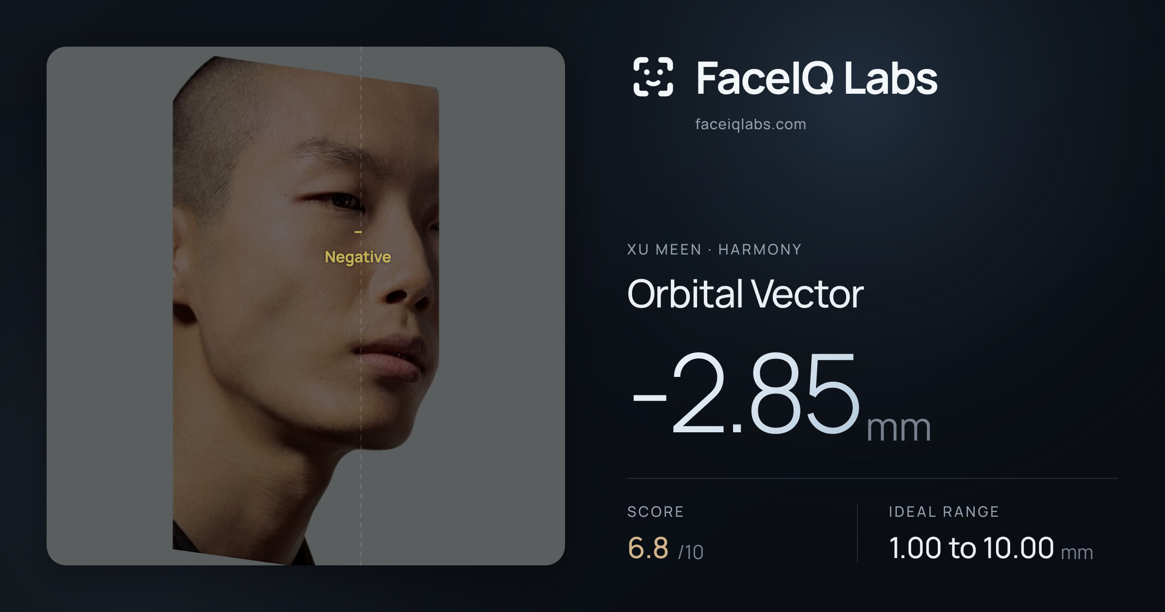 Xu Meen Orbital Vector: -2.85mm, drawn on the photo