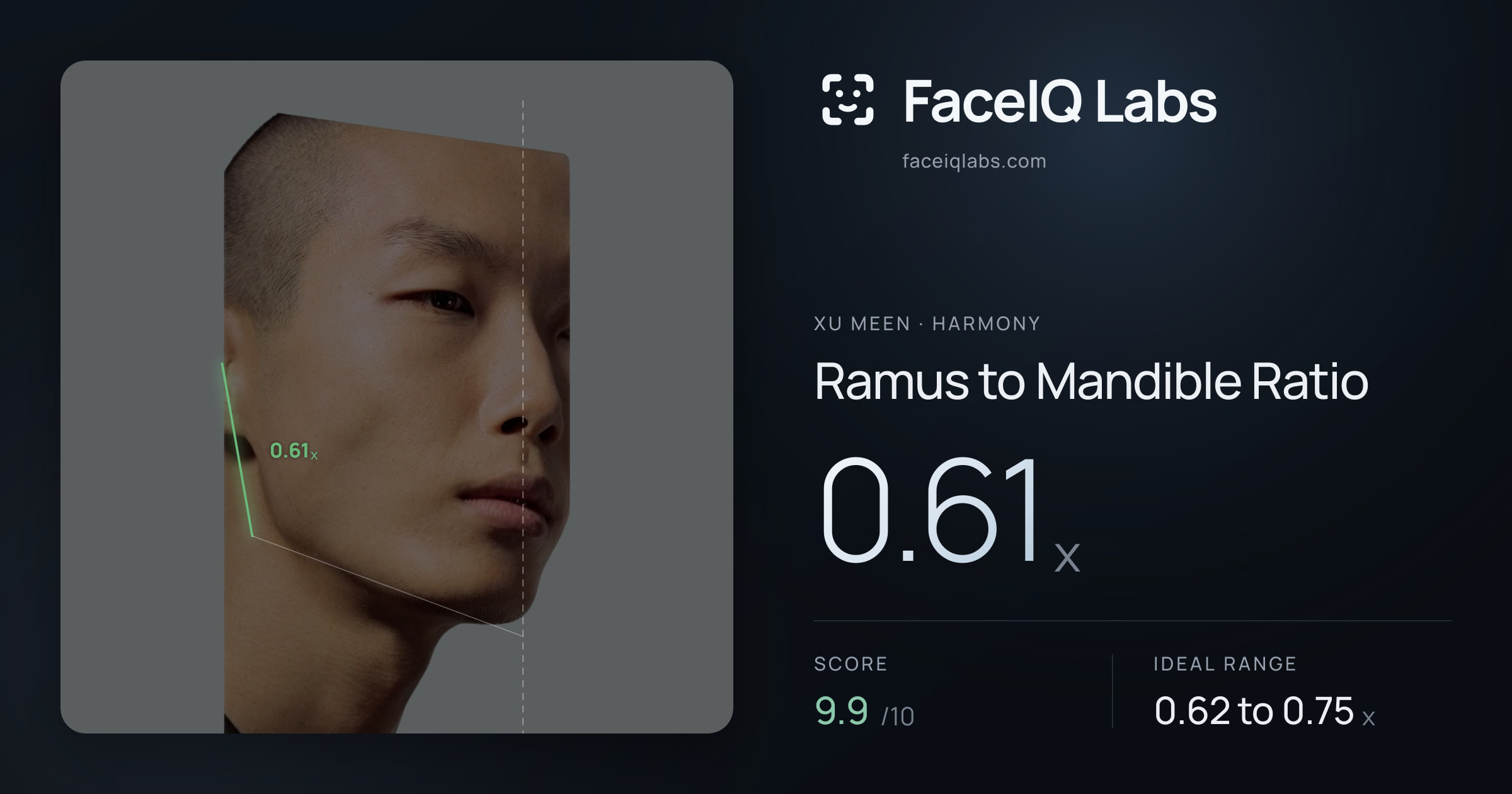Xu Meen Ramus to Mandible Ratio: 0.61x, drawn on the photo
