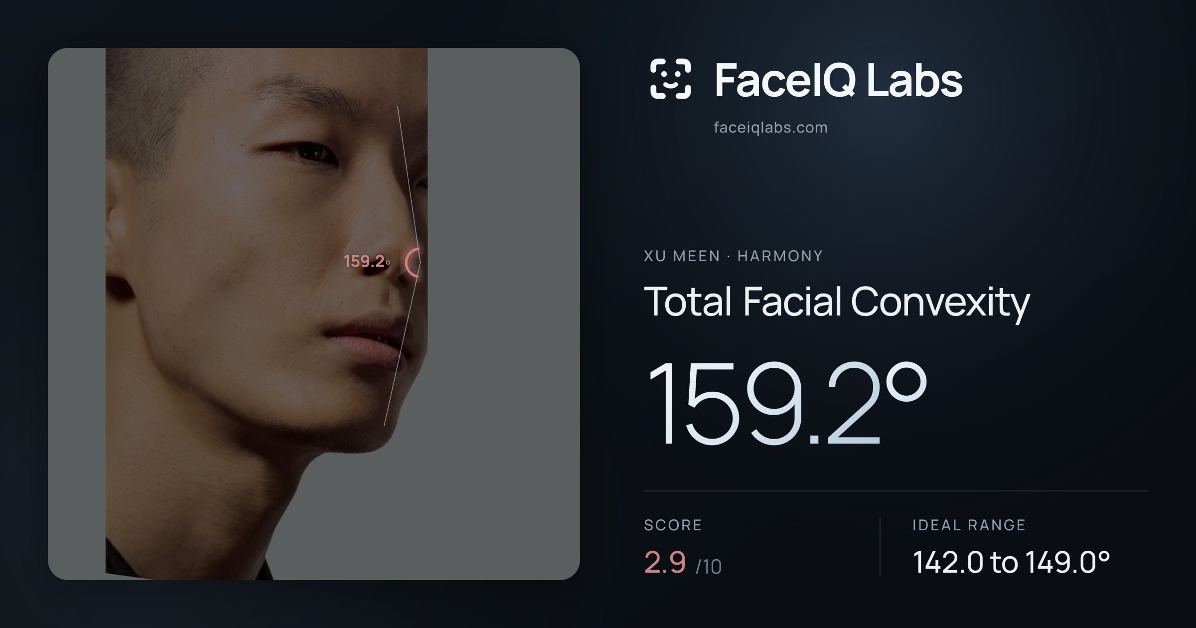 Xu Meen Total Facial Convexity: 159.2°, drawn on the photo
