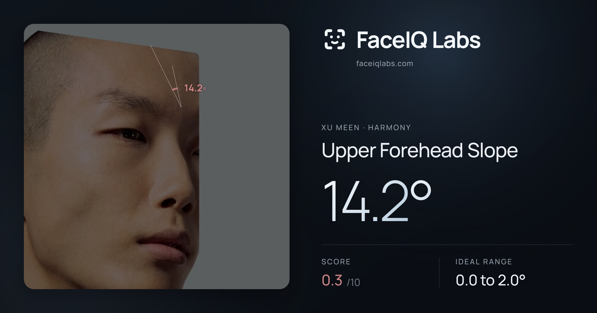 Xu Meen Upper Forehead Slope: 14.2°, drawn on the photo