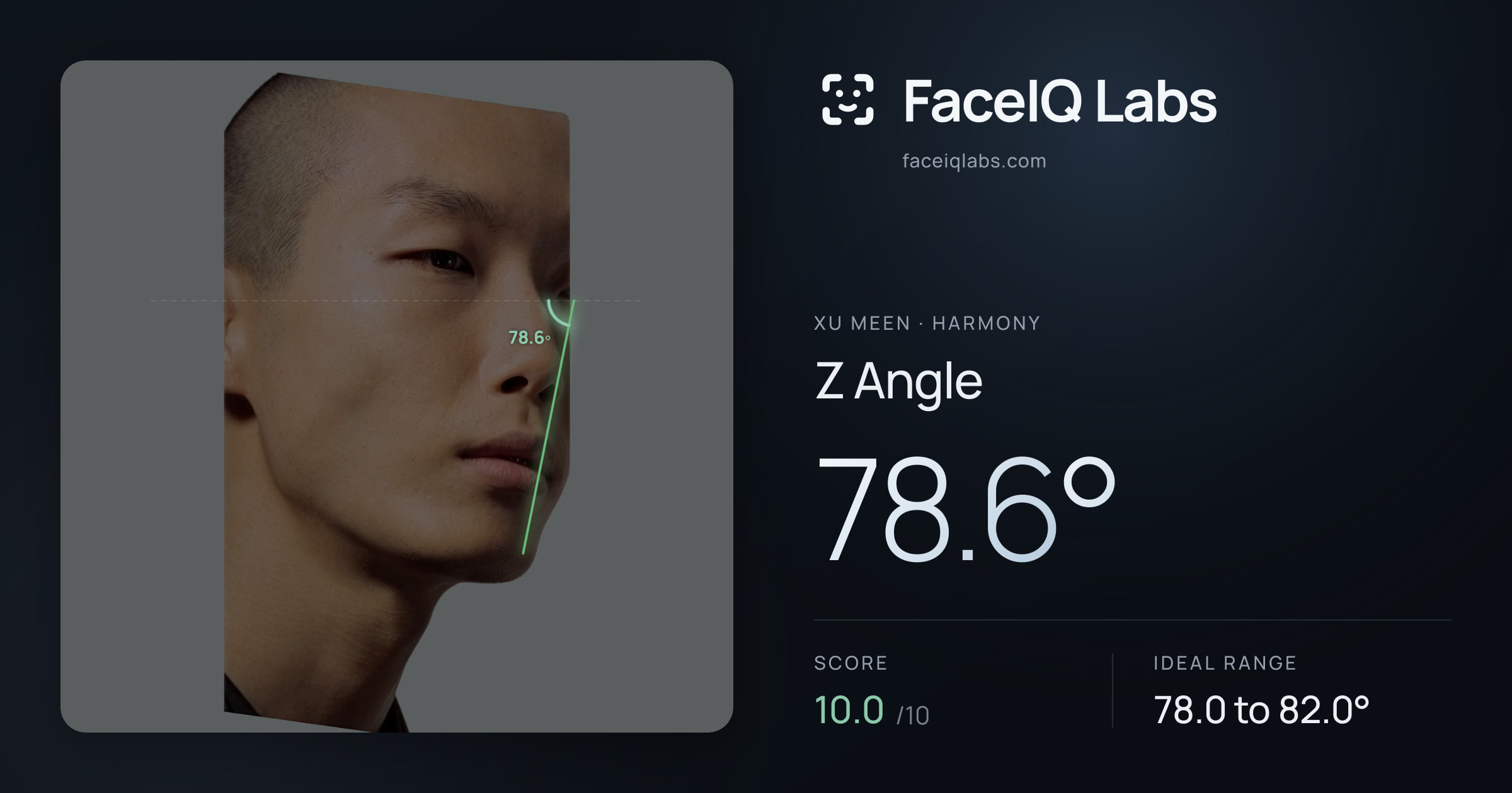 Xu Meen Z Angle: 78.6°, drawn on the photo