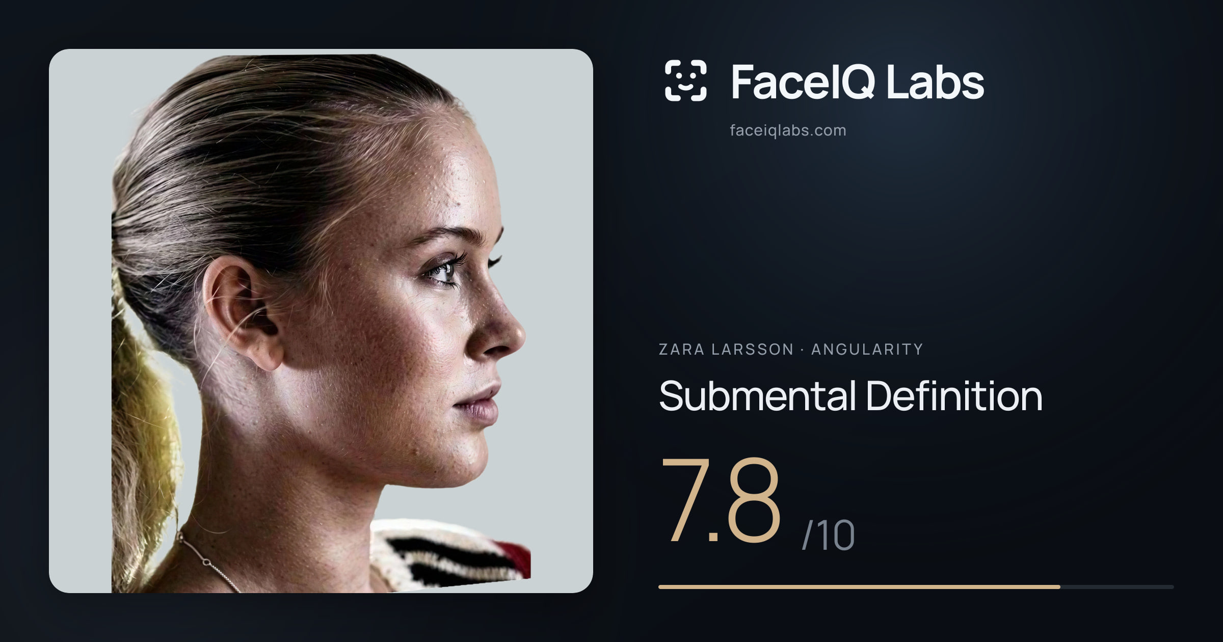 Zara Larsson Submental Definition: 7.8/10, drawn on the photo