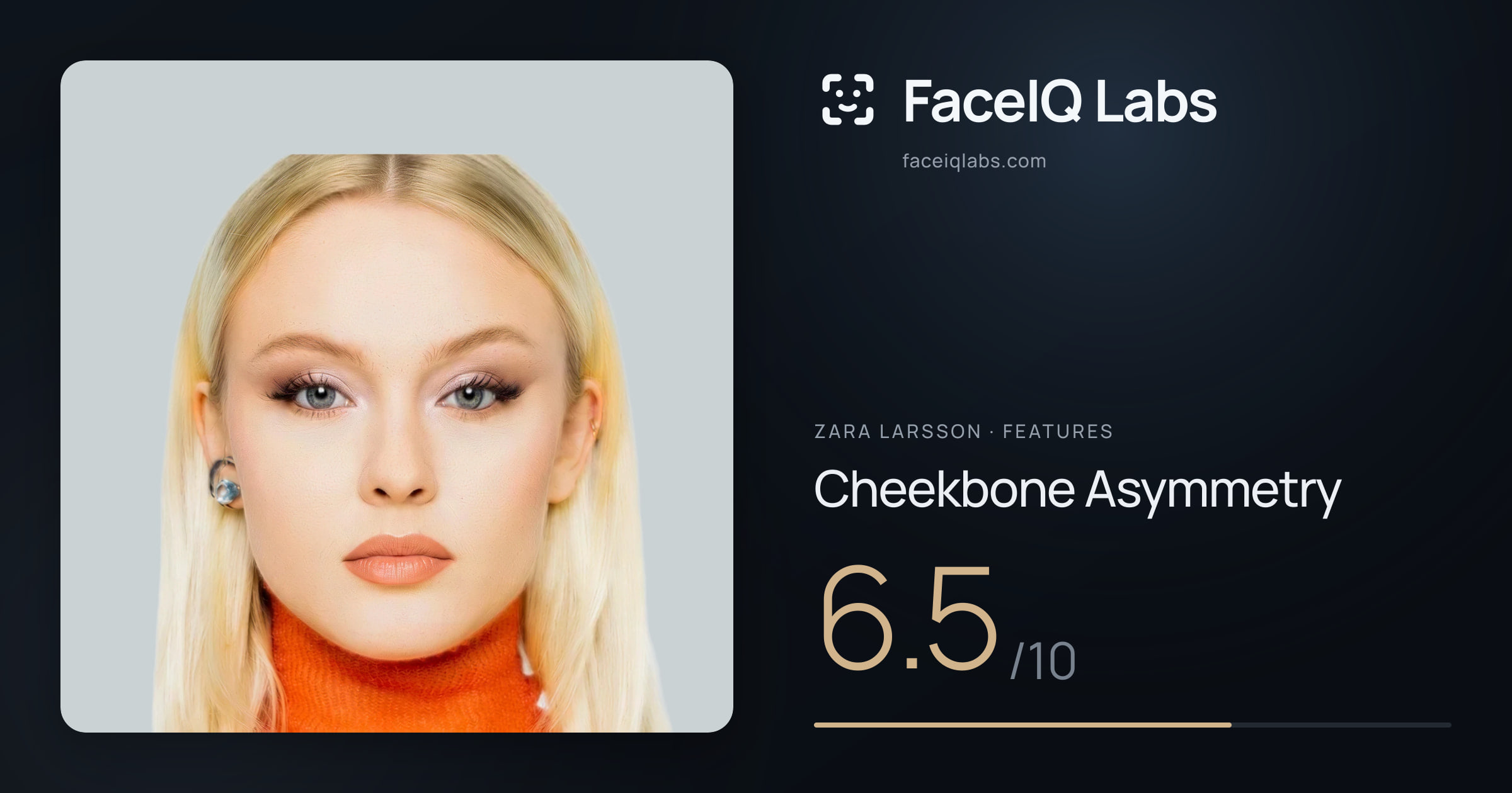 Zara Larsson Cheekbone Asymmetry: 6.5/10, drawn on the photo