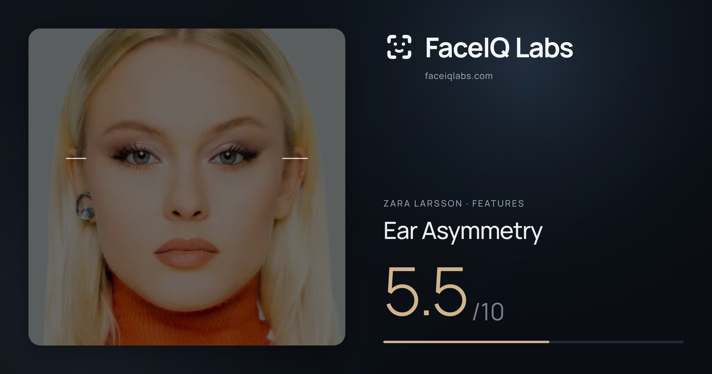 Zara Larsson Ear Asymmetry: 5.5/10, drawn on the photo