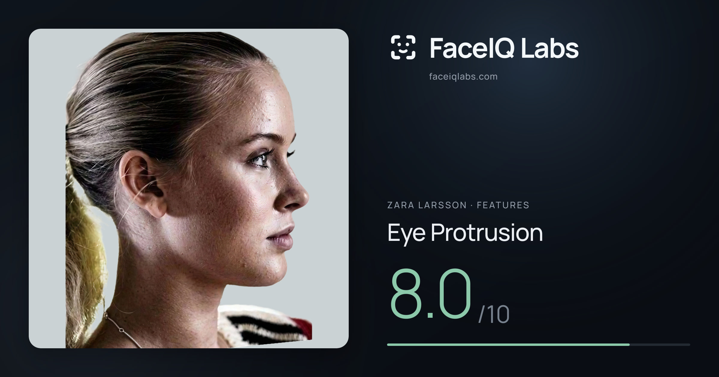 Zara Larsson Eye Protrusion: 8.0/10, drawn on the photo