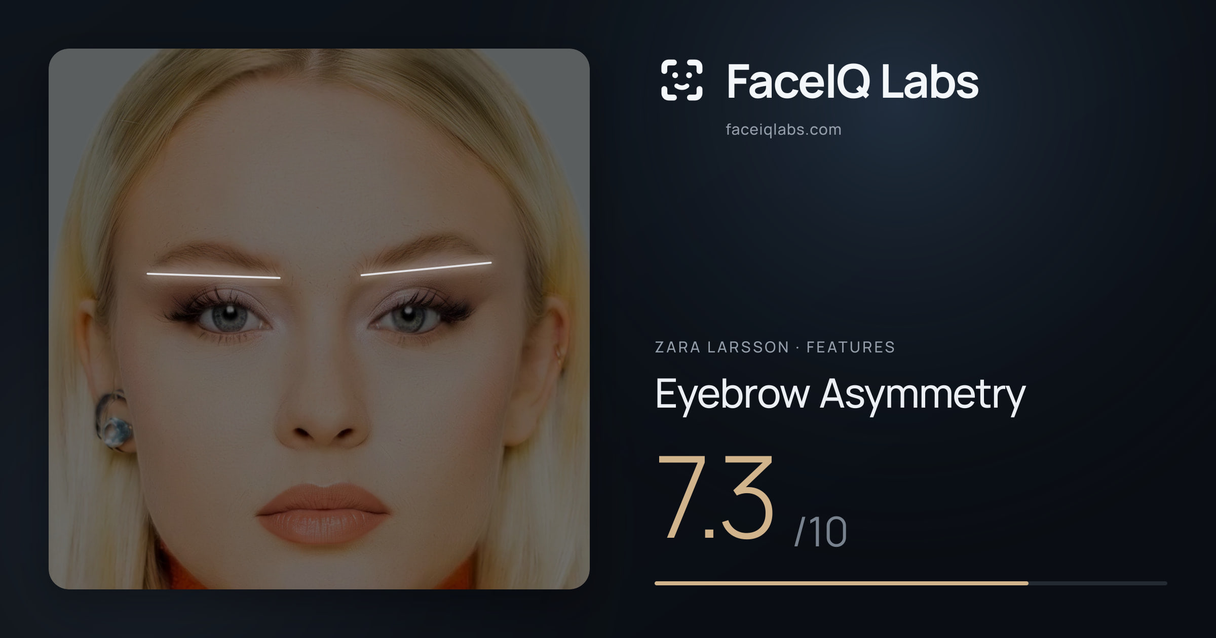 Zara Larsson Eyebrow Asymmetry: 7.3/10, drawn on the photo